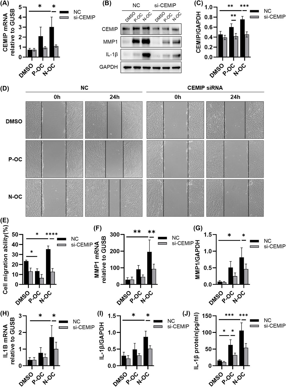 Experimental data image showing the effects of CEMIP knockdown on cell behavior. (A) Bar graph illustrating CEMIP mRNA levels relative to GUSB in different treatments. (B) Western blot showing protein expression of CEMIP, MMP1, IL-1β, and GAPDH under various conditions. (C) Bar graph depicting CEMIP/GAPDH ratio. (D) Wound healing assay images at 0 and 24 hours under different treatments for NC and si-CEMIP. (E-J) Various bar graphs showing parameters like cell migration ability, MMP1 mRNA, IL-1β mRNA, and protein levels in NC and si-CEMIP groups. Significant differences are indicated by asterisks.