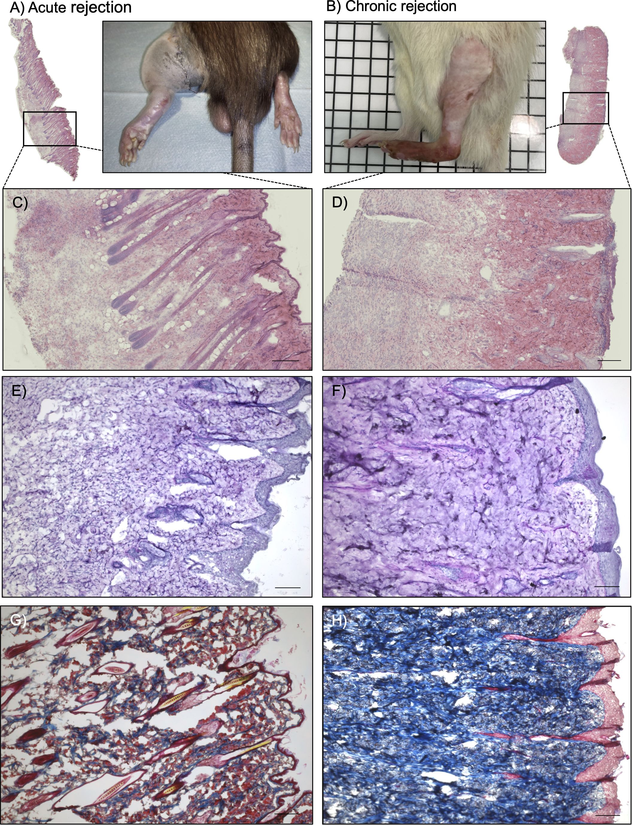 Two sections compare acute and chronic transplant rejection using post-surgery leg photographs and histological slides. Panel A shows acute rejection with a swollen rat leg and accompanying tissue samples C, E, G, indicating inflammation and tissue damage. Panel B displays chronic rejection with a thinning rat leg and complementary tissue images D, F, H, showing scar tissue and structural changes. Each panel highlights differences in rejection pathology, illustrating progression from acute to chronic phases through visual and microscopic views.