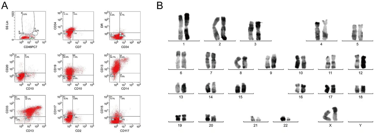 Panel A shows a series of scatter plots with red data points, highlighting expression of cell surface markers like CD46, CD34, CD7, and others. Panel B displays human chromosomes arranged in pairs from 1 to 22, followed by X and Y chromosomes.