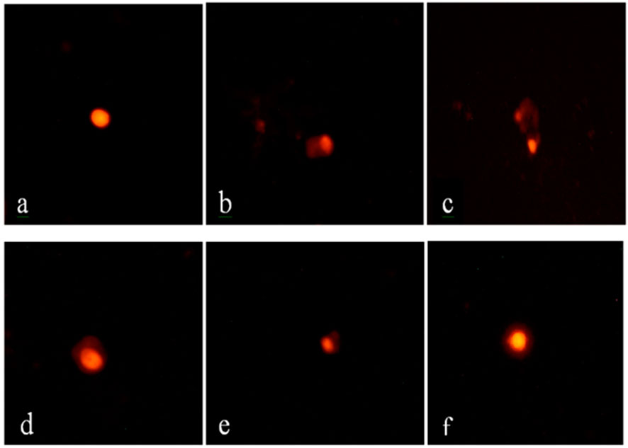 Comet assay of renal tissue: (a) Control shows intact nuclei without DNA damage. (b,c) VM group displays severe DNA damage with extensive tailing. (d,e) VM + DF and VM + CE groups show moderate DNA damage, indicating partial protection. (f) VM + DF + CE group shows minimal DNA tailing, similar to control, suggesting strong protective effects (scale bar = 50 μm).