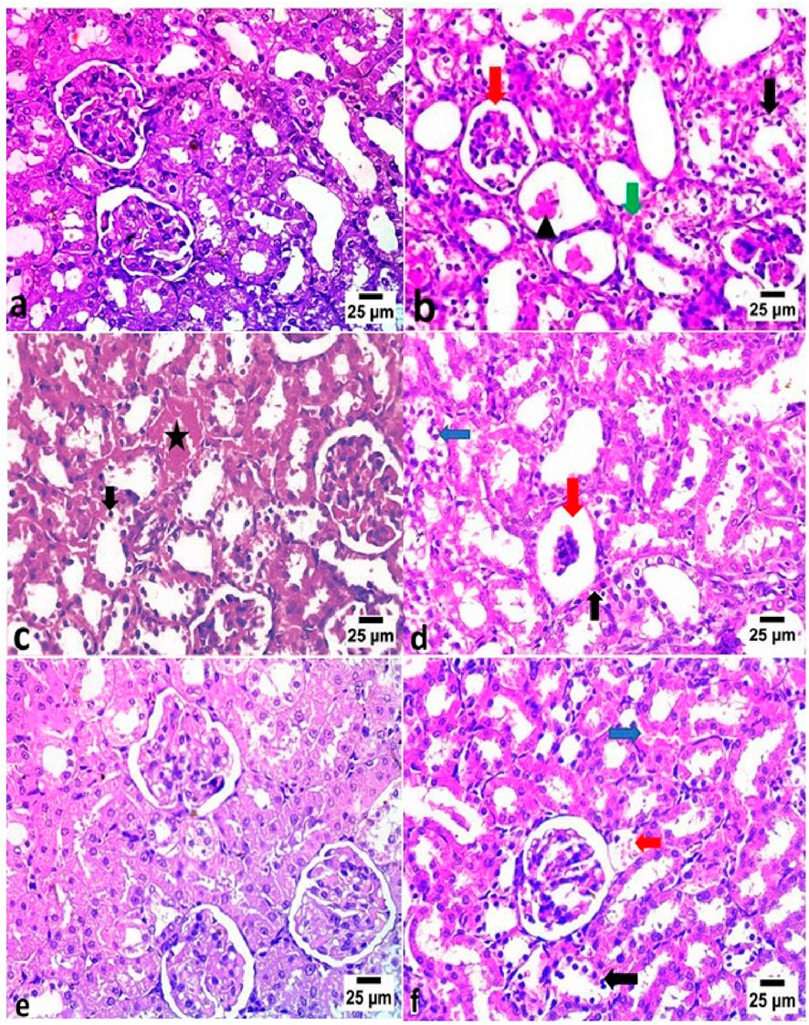Histological images in six panels (a-f) show kidney tissue sections stained with hematoxylin and eosin. Panels exhibit various cellular and structural details, with notable features marked by arrows and stars of different colors, indicating specific tissue components or abnormalities. Each panel is marked with a scale bar of twenty-five micrometers for reference.