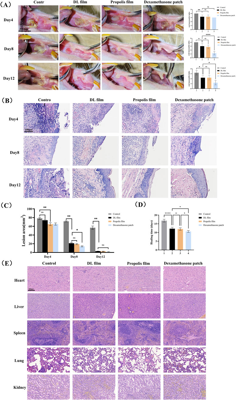 (A) Sequential images show wound healing at Day 4, 8, and 12 using Control, DL film, Propolis film, and Dexamethasone patch, with corresponding bar graphs illustrating wound closure progress. (B) Histological images at Day 4, 8, and 12 demonstrate tissue regeneration with each treatment. (C) Bar graph compares lesion area across treatments over time. (D) Bar graph shows healing time across different treatments. (E) Histopathological images of heart, liver, spleen, lung, and kidney tissues across treatments assess systemic effects.