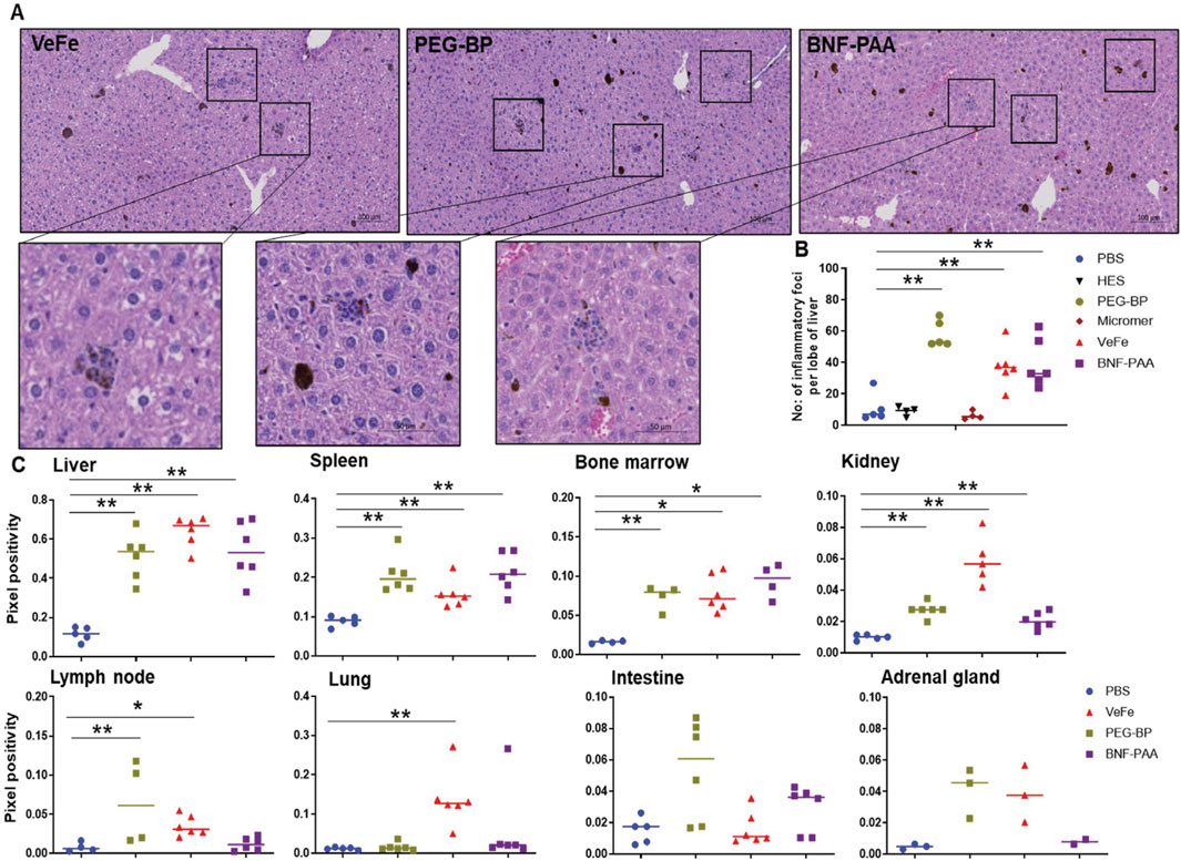 Histological comparison of liver samples in VeFe, PEG-BP, and BNF-PAA treatments. Enlarged views highlight cellular details. Graph B shows the number of inflammatory foci per liver lobe across treatments. Graph C presents pixel positivity in liver, spleen, bone marrow, kidney, lymph node, lung, intestine, and adrenal gland, with treatments indicated by different shapes and colors. Statistical significance is marked.