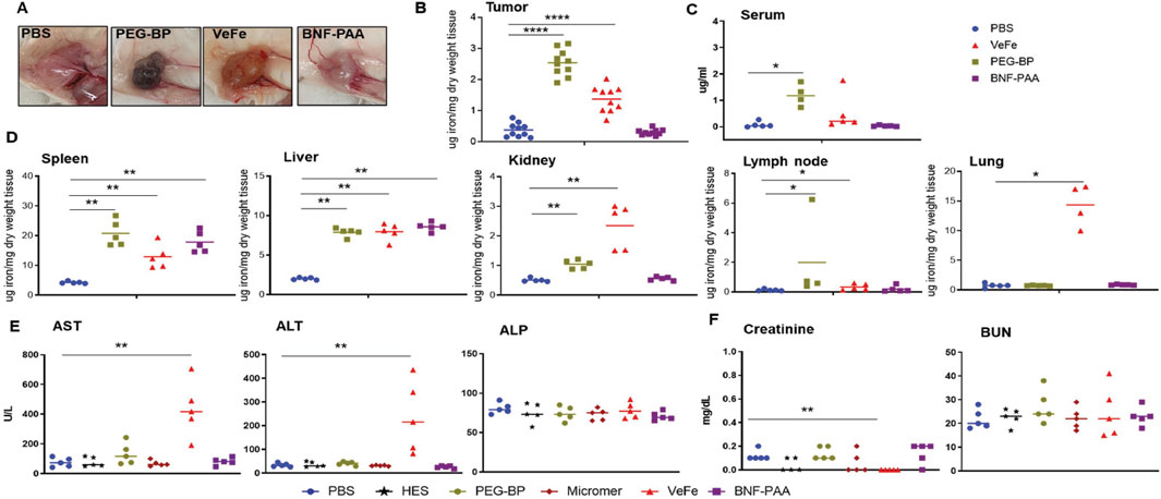 Panel A shows images of tumors in different treatment groups: PBS, PEG-BP, VeFe, and BNF-PAA. Panels B to F feature graphs indicating levels of iron in tumor, serum, spleen, liver, kidney, lymph node, lung, and measurements of AST, ALT, ALP, creatinine, and BUN. Iron levels are significantly different among treatments, with statistical annotations (*, **, ****) indicating significance levels. Different markers represent treatment groups: blue circles for PBS, red triangles for VeFe, olive squares for PEG-BP, and purple squares for BNF-PAA.