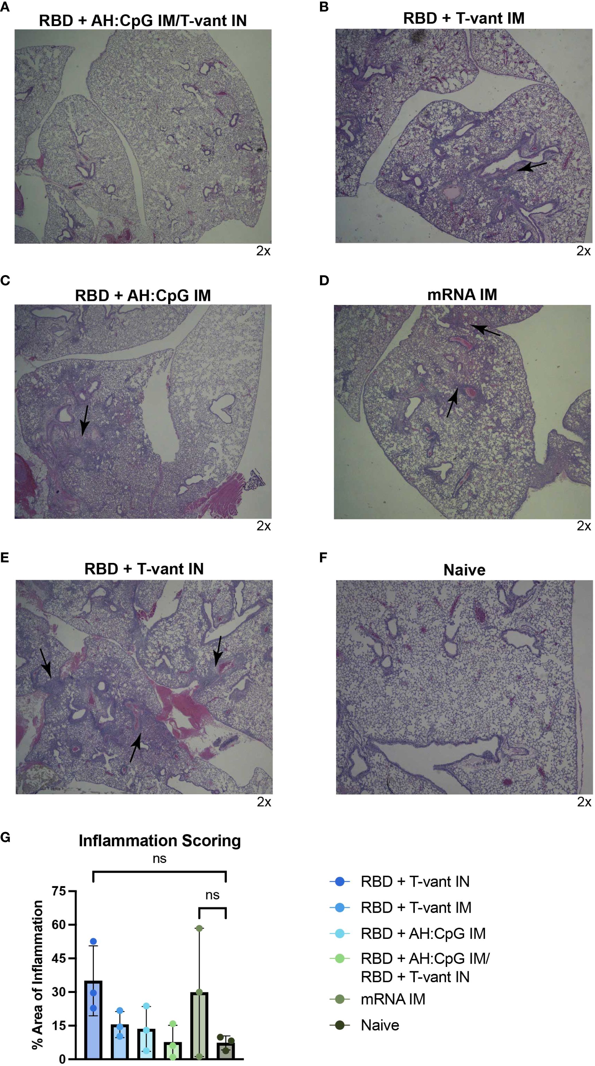 Histological images of lung tissues under different conditions: (A) RBD + AH:CpG IM/T-vant IN, (B) RBD + T-vant IM, (C) RBD + AH:CpG IM, (D) mRNA IM, (E) RBD + T-vant IN, and (F) Naive. Each image shows variations in tissue inflammation. Panel (G) is a bar graph displaying the percentage area of inflammation across these conditions. Arrows highlight specific areas of interest in the lung tissue images.