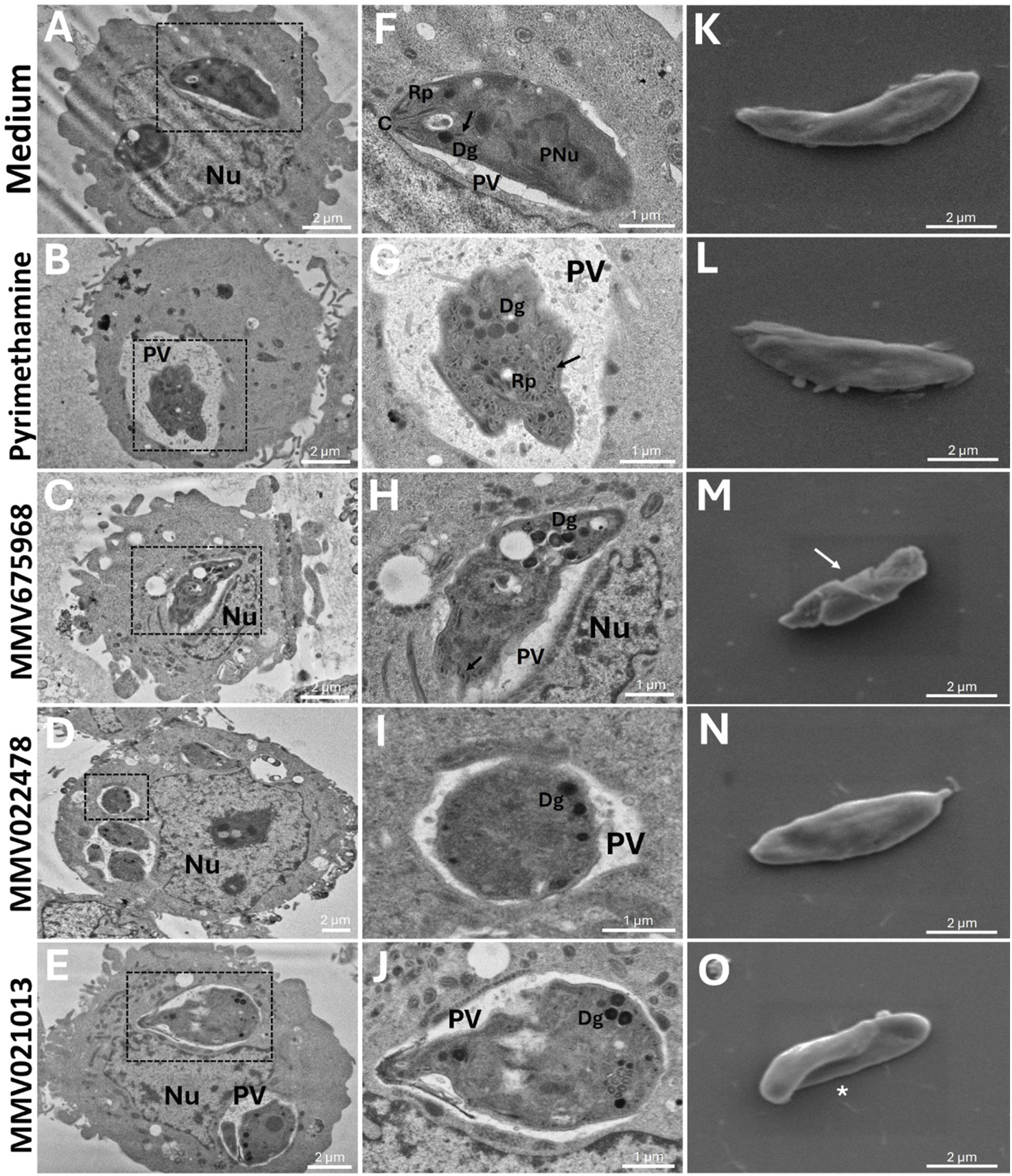 Electron microscopy images show cellular structures under different conditions (Medium, Pyrimethamine, MMV675968, MMV022478, MMV021013). Panels A-E display cross-sections with labels like Nu (nucleus) and PV (parasitophorous vacuole), indicating regions of interest. Panels F-J zoom into specified structures, highlighting elements like Dg (densely granulated structures), Rp (ribosomal particles), and more. Panels K-O provide surface views of the cell contours, comparing morphological changes under each condition. Various cellular features are labeled to study the effects of compounds or conditions on cellular morphology.