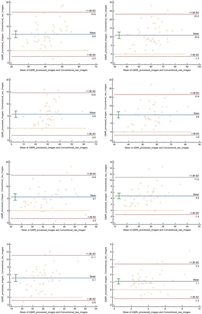 Two Bland-Altman plots comparing iQMR processed images with conventional raw images. Left plot shows Achilles tendon-Flexor hallucis longus CNR with mean 9.8, limits of agreement at +21.6 and -1.9. Right plot shows Kager's fat pad-Achilles tendon CNR with mean 5.7, limits at +14.6 and -3.3. Data points are individually plotted with error bars.
