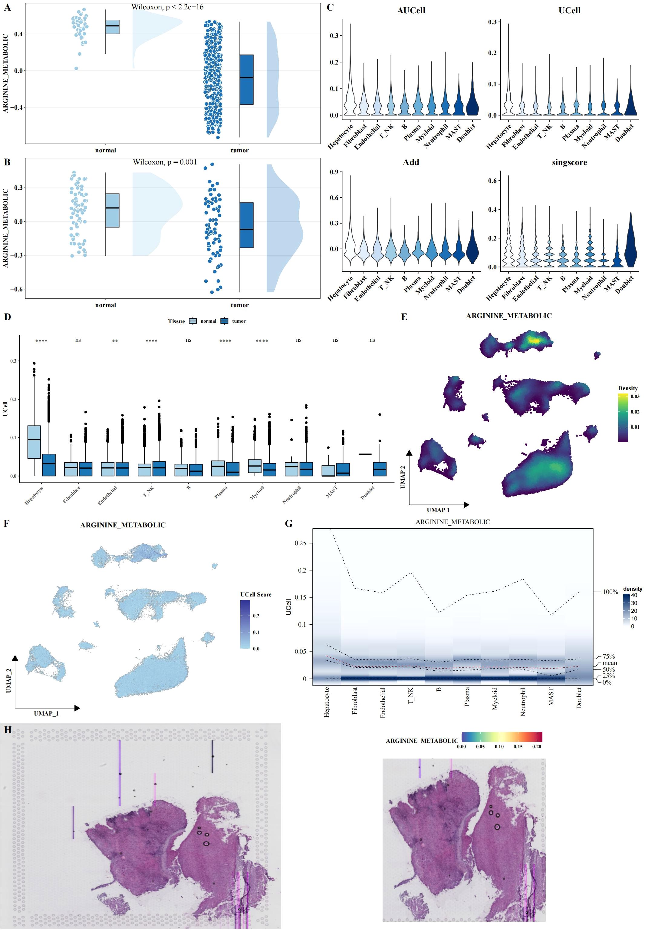 Two boxplots, labeled A and B, compare arginine metabolic activity in normal and tumor tissues, showing significant differences. Panel C displays four sets of violin plots representing AUCell, UCell, Add, and singscore metrics across various cell types. Panel D presents a boxplot for UCell scores across different tissues, noting statistical significance. Panel E is a UMAP plot visualizing density variations in metabolic activity. Panel F depicts a UMAP plot with color-coded UCell scores. Panel G shows a density plot of UCell scores across cell types. Panel H contains two histological images stained to highlight arginine metabolism.