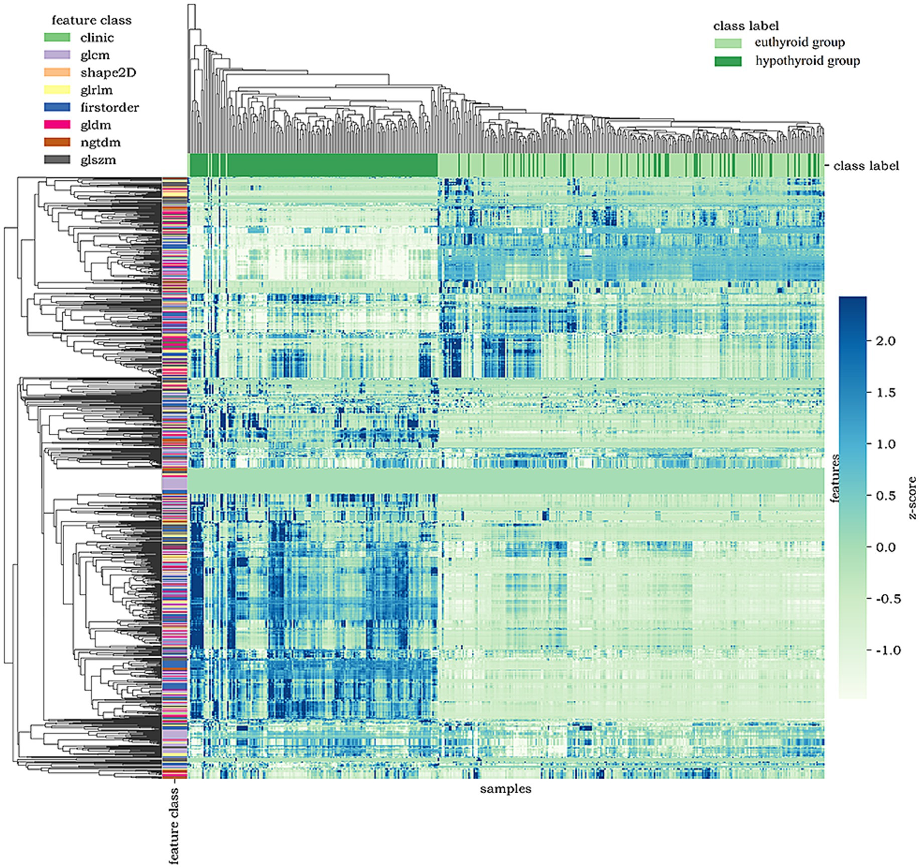 Heatmap displaying hierarchical clustering of features and samples, categorized by feature classes and class labels. The rows represent different feature classes, such as clinic and gldm, while columns represent samples grouped into euthyroid and hypothyroid classes. Color gradient represents z-scores, ranging from light green for low scores to dark blue for high scores.