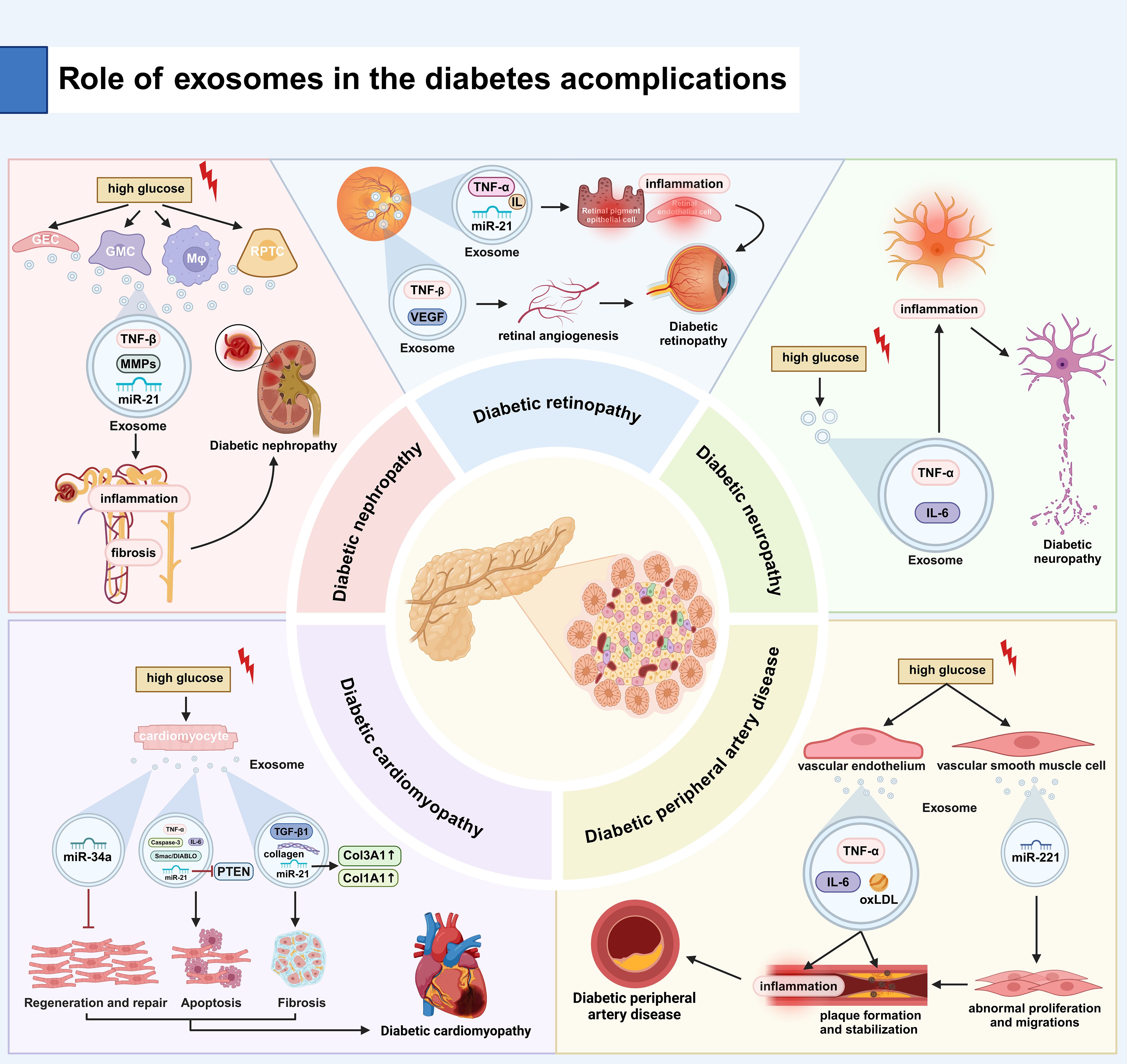 Diagram illustrating the role of exosomes in diabetes complications, featuring diabetic nephropathy, retinopathy, neuropathy, cardiomyopathy, and peripheral artery disease. Each section shows high glucose levels leading to inflammation and fibrosis, with exosomes carrying factors like TNF-α and miR21 contributing to disease progression. Central pancreas illustration links these conditions.