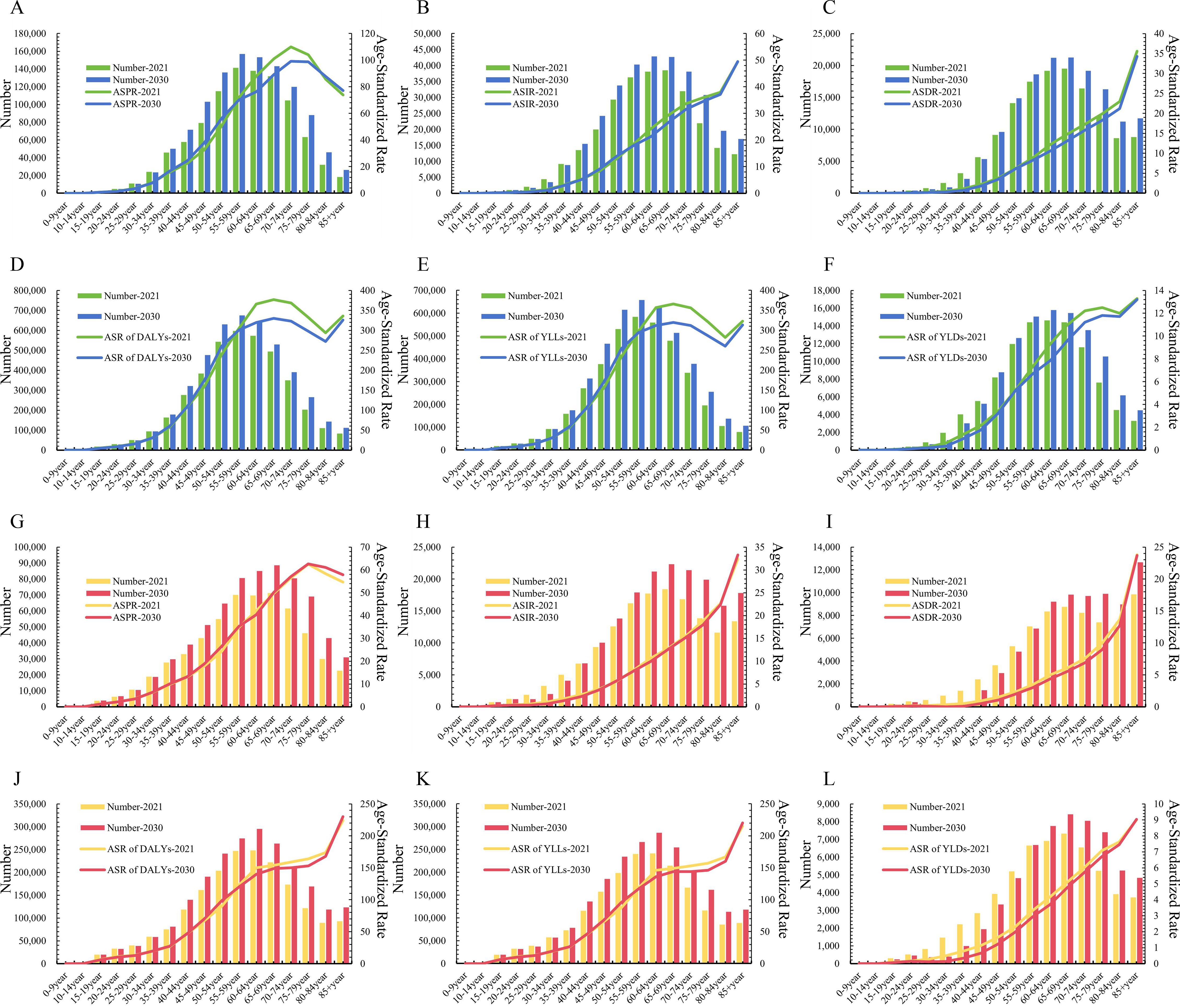 Twelve bar and line charts labeled A to L illustrate trends in numbers and ASR across various metrics from 1990 to 2021, comparing data for 2021 and 2030. Each chart uses different colored bars and lines to differentiate the sexes. Data categories include Number-2021, Number-2030, and ASR-2021, ASR-2030.