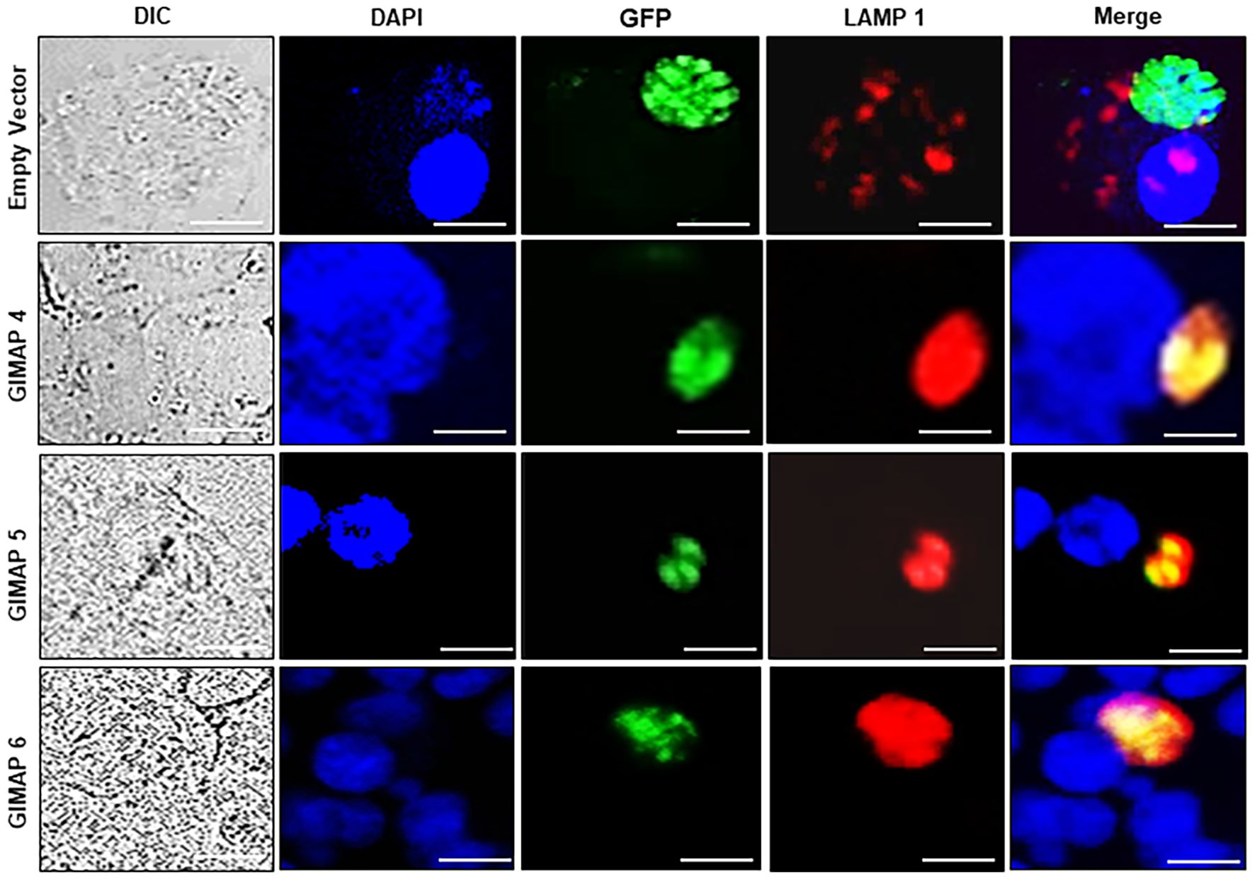 A series of microscopy images showing four experimental conditions: Empty Vector, GIMAP 4, GIMAP 5, and GIMAP 6. Each row includes images under DIC, DAPI, GFP, LAMP 1, and Merge filters. DIC images show cell structures; DAPI images highlight blue-stained nuclei; GFP images display green fluorescence; LAMP 1 images reveal red staining, and Merge images combine fluorescence. Differences in staining patterns are visible across the rows and columns.