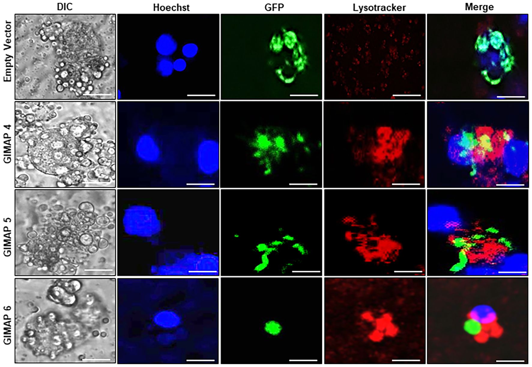 Microscopy images display four rows labeled Empty Vector, GIMAP 4, GIMAP 5, and GIMAP 6, each with five columns: DIC, Hoechst, GFP, Lysotracker, and Merge. The DIC images show cell structures, Hoechst shows blue nuclei, GFP highlights green areas, Lysotracker shows red markers, and the Merge combines these elements. Scale bars are included for reference.