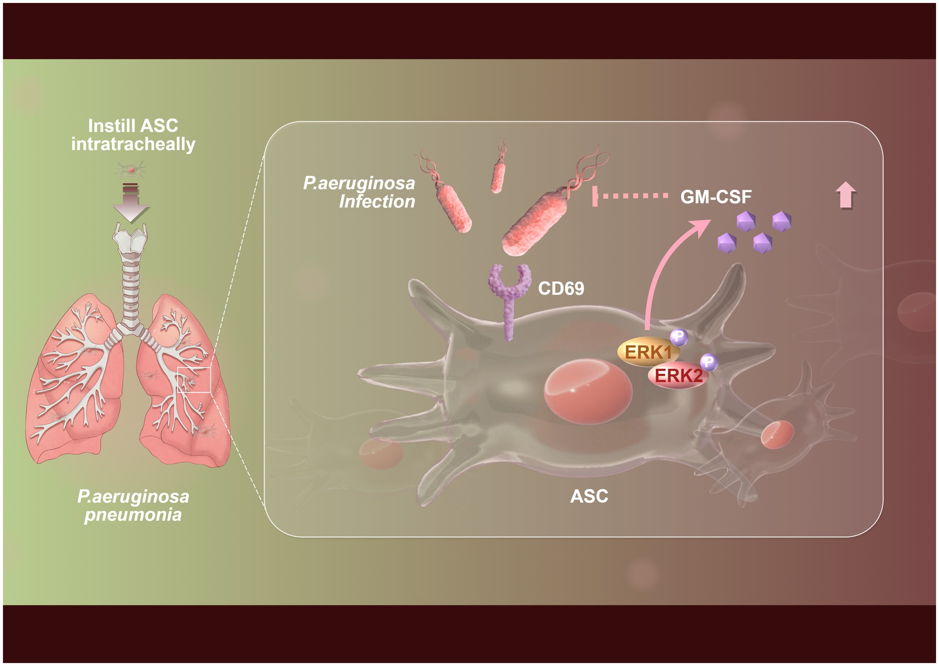 Diagram showing the process of instilling ASC intratracheally to treat Pseudomonas aeruginosa pneumonia. It illustrates infected lungs and a magnification of ASC at the cellular level. Components include CD69, ERK1, ERK2, GM-CSF, and P. aeruginosa bacteria. Arrows depict the pathway, indicating cellular interactions and signaling.