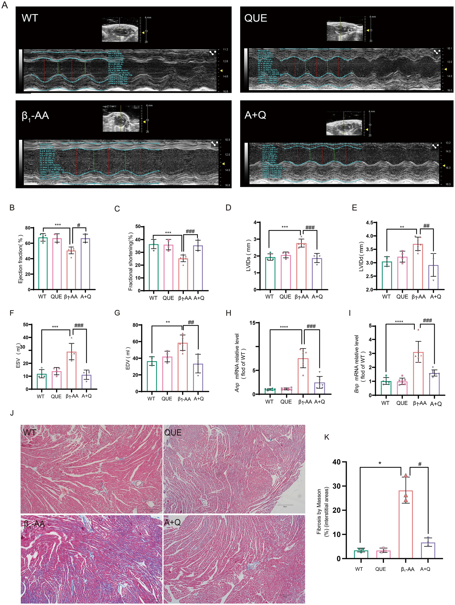 Panels A-G: Cardiac function parameters (EF%, FS%, LVIDd, LVIDs, ESV, EDV) by echocardiography. Panels H-I: Anp and Bnp mRNA levels in heart tissue. Panel J: Collagen deposition via Masson's staining (blue fibers). Panel K: Collagen quantification. Statistical markers show group comparisons.