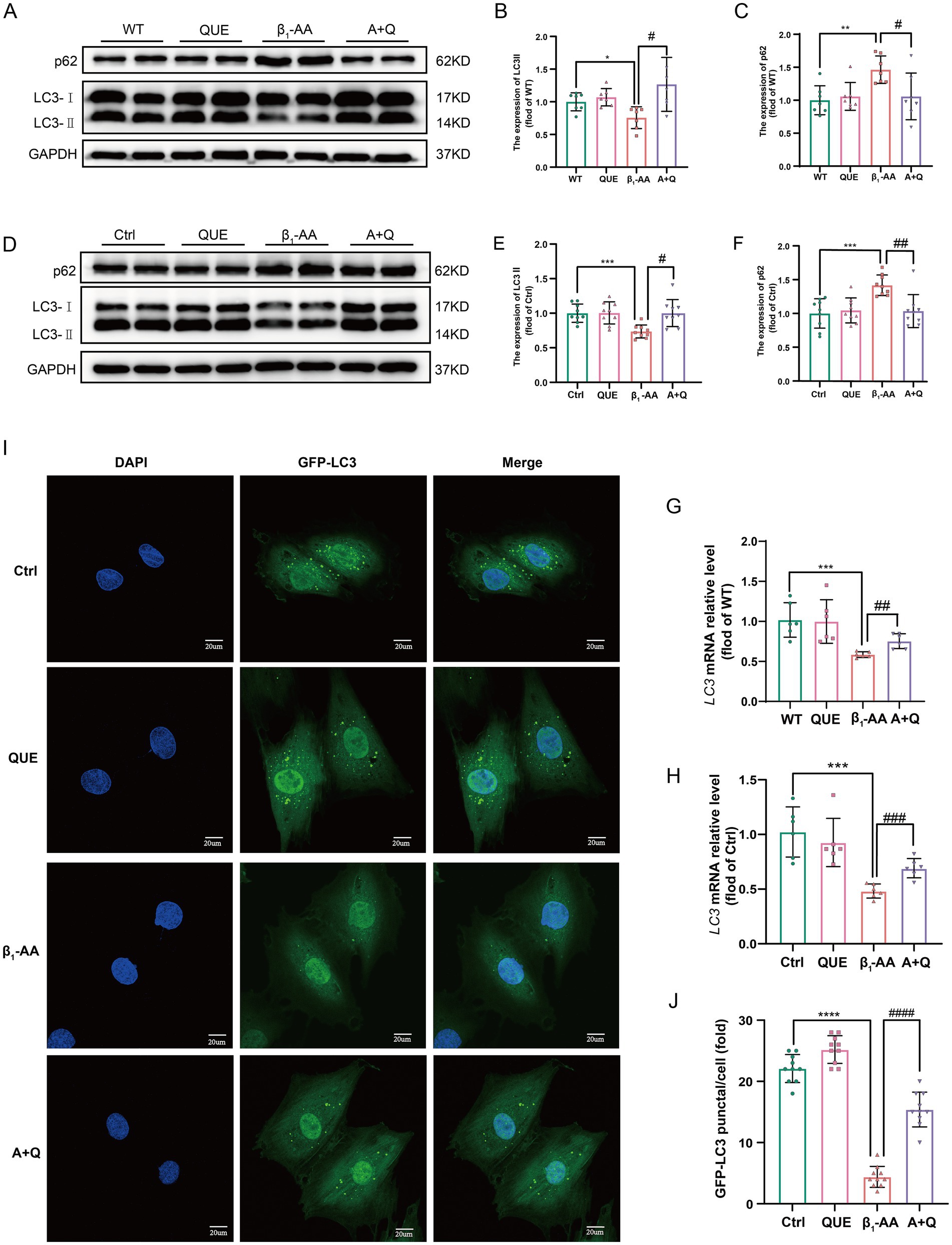 Panel A: Western blot of LC3 and p62 in β1-AR-ECII immunized mice with quercetin treatment. Panel D: LC3 and p62 levels in β1-AA exposed H9c2 cells. Panel G: LC3 mRNA in immunized mice by RT-PCR. Panel H: LC3 mRNA in β1-AA treated H9c2 cells. Panel I: Immunofluorescence of LC3 puncta. Panel J: LC3 puncta quantification. Panels B, C, E, F: Statistical charts for LC3 and p62 expression.