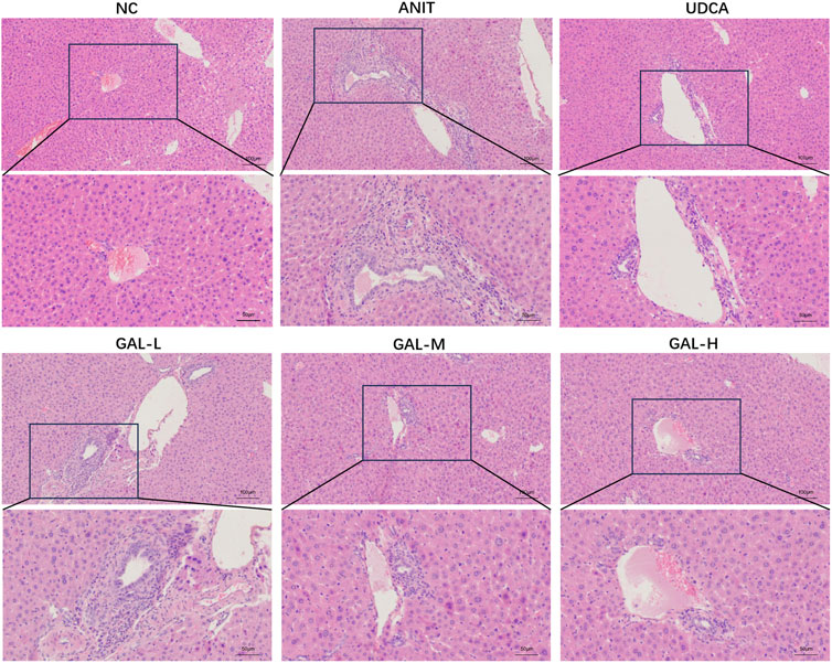 Microscopic images of liver tissue sections, stained and magnified, showing different treatment groups labeled NC, ANIT, UDCA, GAL-L, GAL-M, and GAL-H. Each group displays an overview and a detailed view of the tissue structure. Variations in cell arrangements and structures are evident between the treatment groups.
