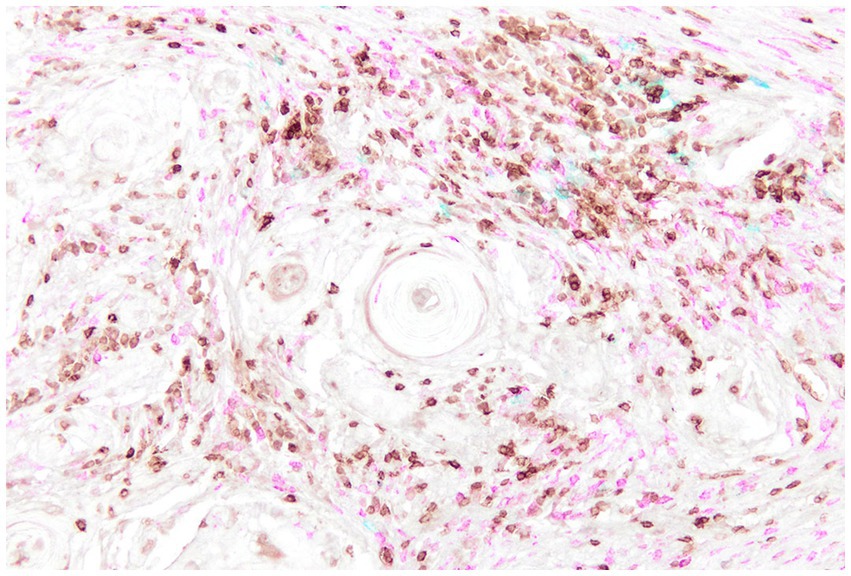Microscopic image showing tissue stained with various colors. Brown, blue and purple cells are scattered throughout a light background. Some cells are clustered, revealing variations in staining intensity, indicating different cell types or structures.