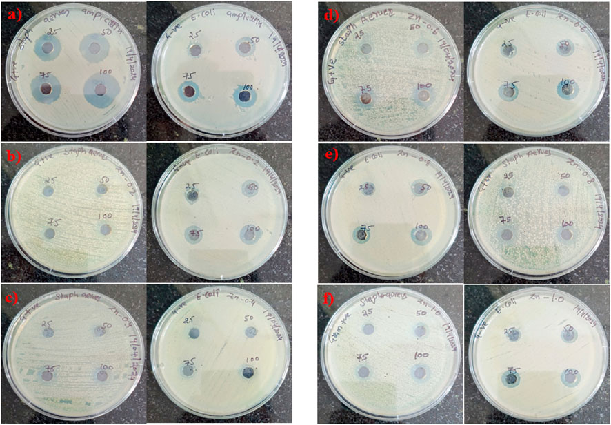 Six panels labeled a) to f) show Petri dishes with different bacterial cultures and antibiotic treatments. Each dish features four discs labeled with different concentrations: 25, 50, 75, and 100. The dishes contain either E. coli or Staphylococcus aureus and have handwritten notes about the experiment conditions, such as the date and compound used. The zones of inhibition around the discs vary in size, indicating the effectiveness of each concentration.