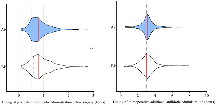 Violin plots comparing antibiotic administration timing. Left plot: Prophylactic antibiotics before surgery in hours, showing two data sets Ai and Bi, with Ai shaded in blue. Right plot: Intraoperative additional antibiotics, depicting the same data sets with Ai in blue.