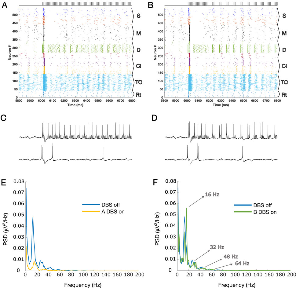 Diagram composed of several panels: A and B show neuronal activity over time with varying neuron types annotated as S, M, D, Cl, TC, and Rt. C and D display comparative electrical waveforms. E and F are line graphs showing power spectral density (PSD) versus frequency, comparing DBS off and on states, with distinct responses at different frequencies labeled 16, 32, 48, and 64 Hz.