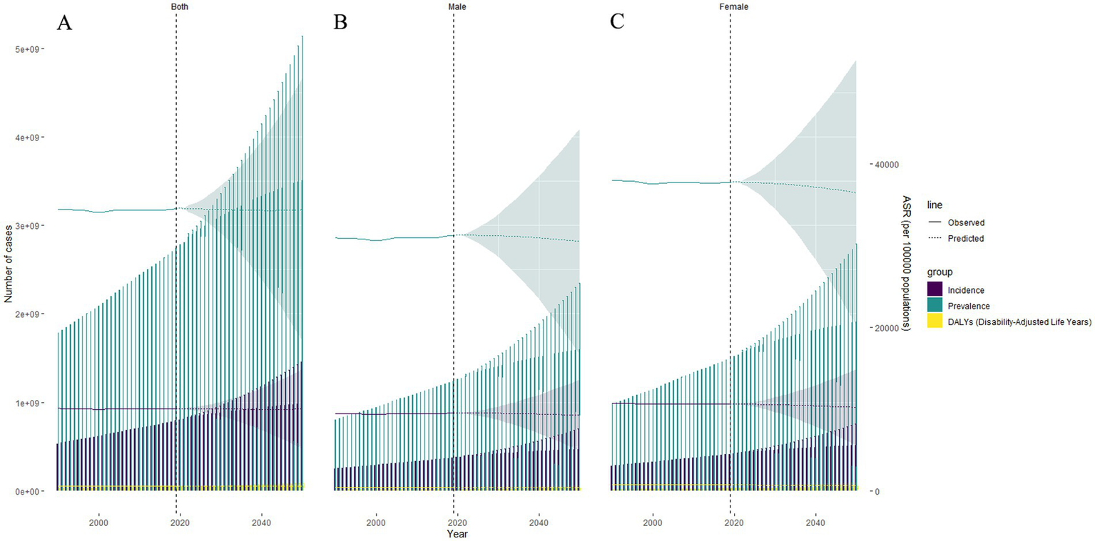 Three-panel chart showing observed disease case counts and age-standardized rates from 2000 to 2021, and their projections from 2021 to 2050, stratified by sex. Panel A depicts combined data for both sexes, Panel B for males, and Panel C for females. Solid and dashed lines represent observed and predicted age-standardized rates (ASR) per 100,000 population, respectively. Bars represent case counts, and shaded areas indicate the 95% uncertainty intervals (UI). The legend indicates group colors: incidence in purple, prevalence in blue, and DALYs in yellow. The data suggests an increasing trend in case counts over time for all groups and categories.