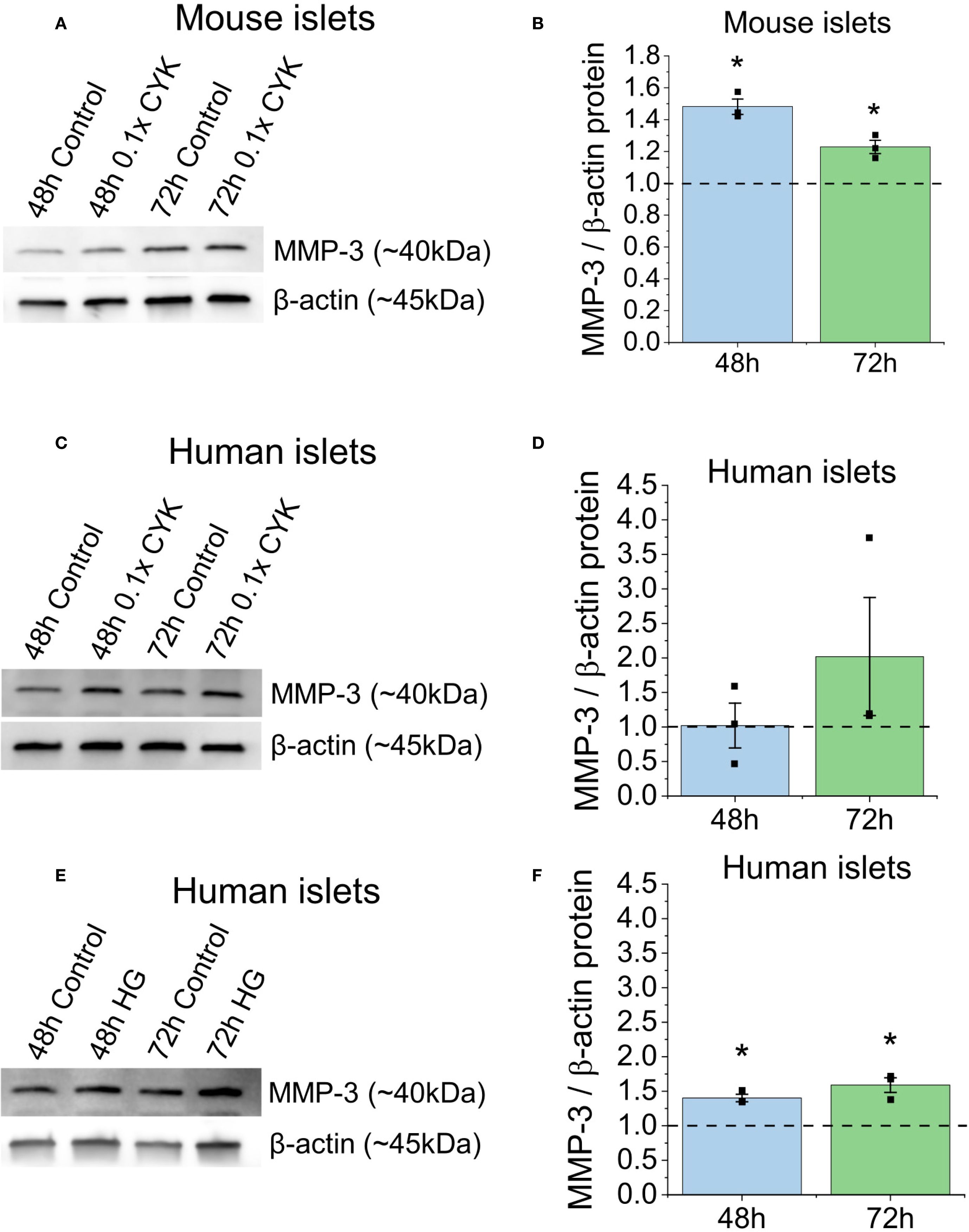 Western blot and bar graphs analyzing MMP-3 and β-actin protein levels. Images A and B show mouse islets with treatments for control, 0.1x CYK at 48 and 72 hours, indicating increased MMP-3/β-actin ratio with treatment. Images C and D depict human islets treated similarly, showing increases at 72h. Images E and F illustrate human islets treated with high glucose, displaying an increased MMP-3/β-actin ratio at 48 and 72 hours. Bar graphs highlight statistical significance.