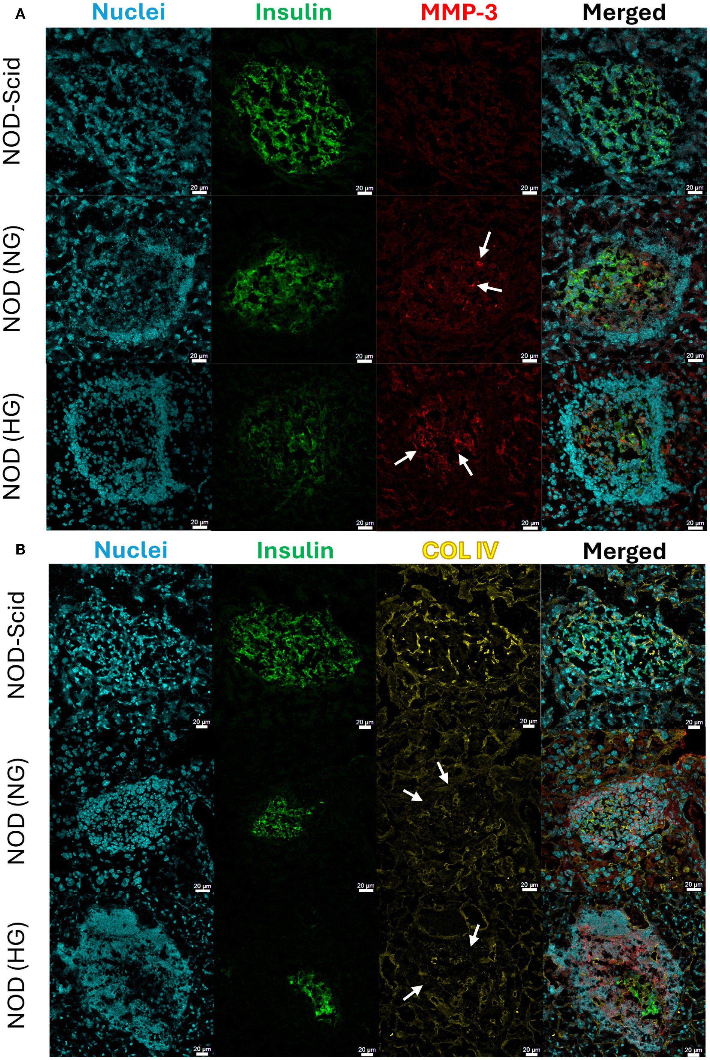 Fluorescent microscopy images showing two separate panels labeled A and B, each with three rows representing NOD-Scid, NOD (NG), and NOD (HG) samples. Panel A depicts nuclei in blue, insulin in green, and MMP-3 in red, with white arrows highlighting regions in some samples. Panel B shows nuclei in blue, insulin in green, and COL IV in yellow, with arrows indicating specific areas. Each image merges these colors to highlight colocalization. Scale bars of twenty micrometers are included in each image.