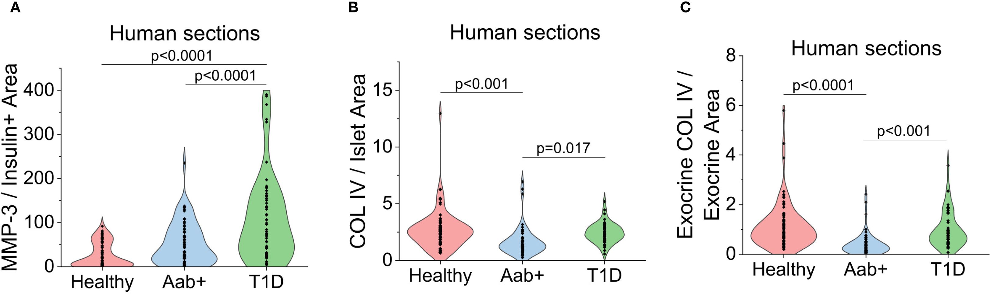 Violin plots comparing human sections in three panels. Panel A shows MMP-3/Insulin+ area among healthy, Aab+, and T1D groups, with T1D showing a significant increase. Panel B displays COL IV/Islet area, significantly higher in healthy than Aab+ and T1D. Panel C illustrates Exocrine COL IV/Exocrine area, significantly higher in healthy. Each plot includes statistical significance values.