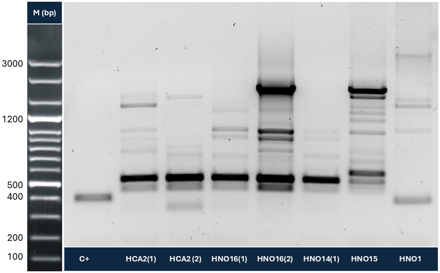 Gel electrophoresis image showing DNA band patterns. The leftmost lane is the molecular marker, indicating sizes from 100 to 3000 base pairs. Lanes C+, HCA2(1), HCA2(2), HNO16(1), HNO16(2), HNO14(1), HNO15, and HNO1 display various DNA bands of differing intensity and size.