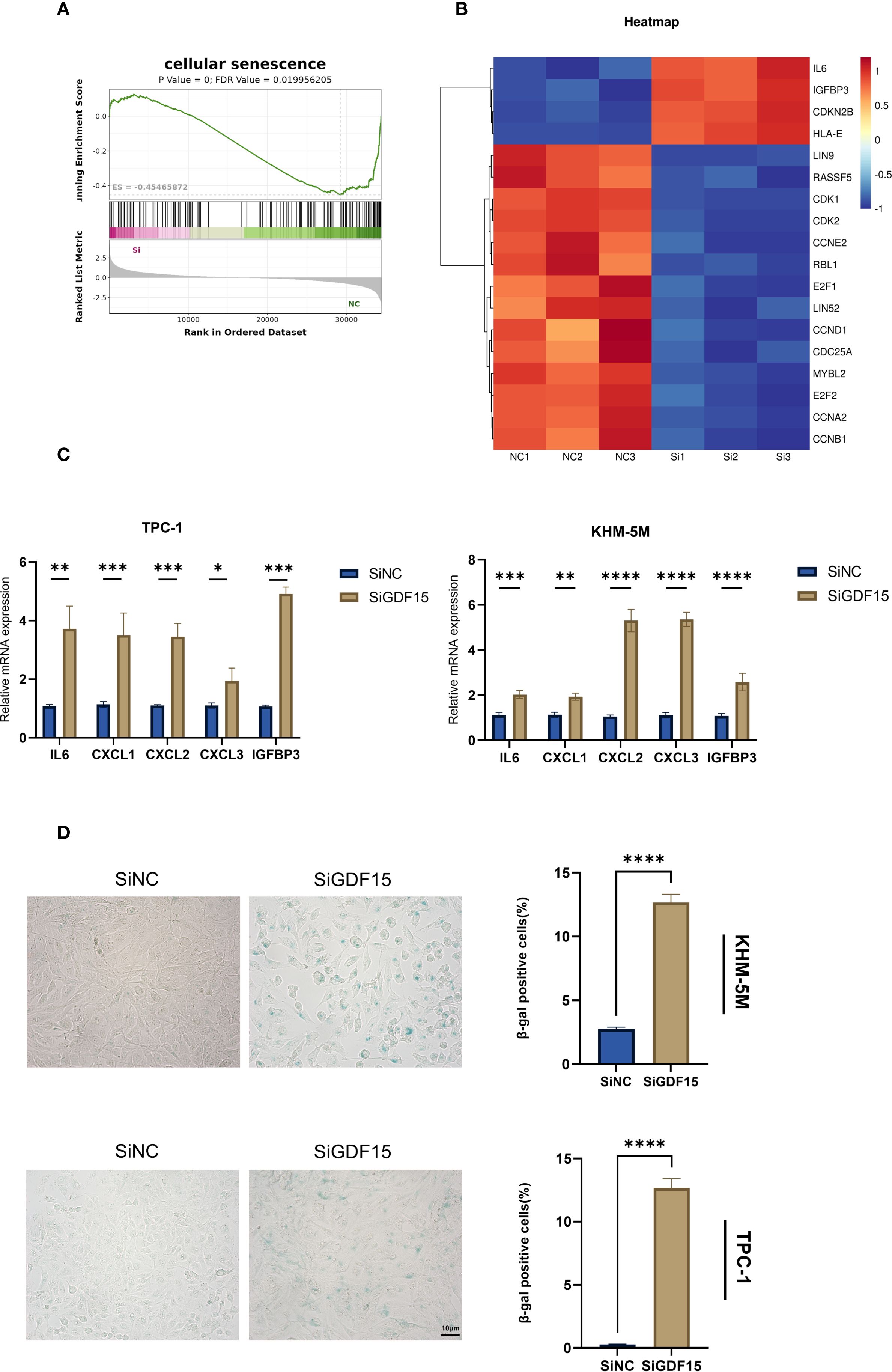 Panel A shows a cellular senescence enrichment plot with significant enrichment score. Panel B presents a heatmap of gene expression for IL6, IGFBP3, and others. Panel C illustrates bar graphs comparing mRNA expression levels in TPC-1 and KHM-5M cells between SiNC and SiGDF15 groups, with significant increases in SiGDF15. Panel D displays microscopic images and bar graphs depicting a higher percentage of β-galactosidase positive cells in the SiGDF15 group compared to SiNC for both KHM-5M and TPC-1 cells.