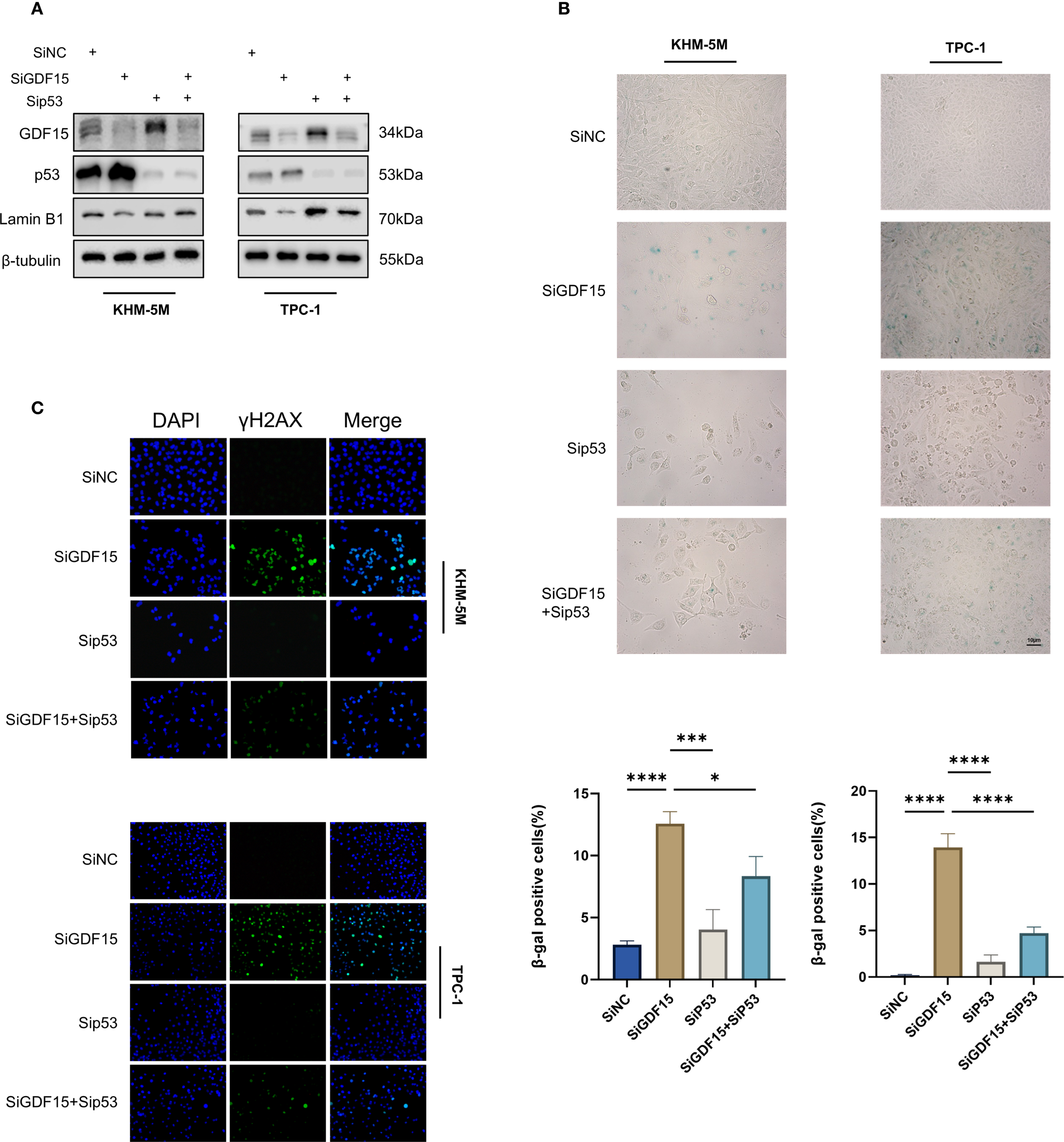 A series of experiments analyzing protein expression and cell behavior with silencing conditions. Panel A shows a Western blot of proteins GDF15, p53, and control proteins in KHM-5M and TPC-1 cell lines under different conditions (SiNC, SiGDF15, Sip53). Panel B includes microscope images of cell lines KHM-5M and TPC-1 treated under similar conditions, highlighting senescence-associated β-galactosidase staining. Panel C presents immunofluorescent images of cells stained with DAPI and γH2AX, showing DNA damage foci under each treatment condition, with accompanying bar graphs quantifying β-galactosidase positive cells. Statistical significance is indicated with asterisks.
