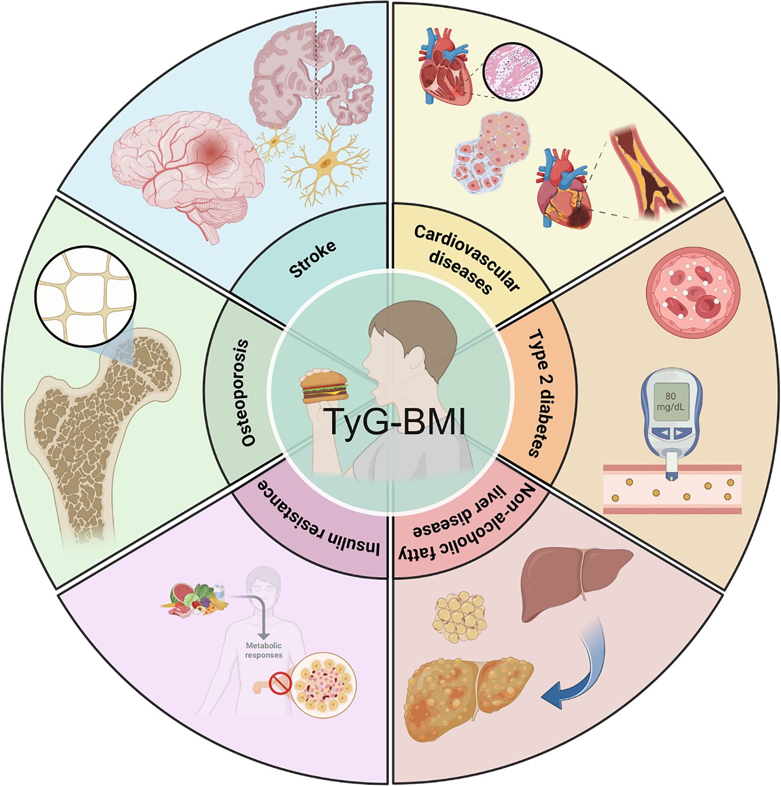 Illustration of a circular diagram divided into six segments around a central figure labeled “TyG-BMI.” The segments depict various health conditions associated with TyG-BMI: stroke with a brain and neurons, cardiovascular diseases with hearts and arteries, type 2 diabetes with blood and a glucose meter, non-alcoholic fatty liver disease with liver images, insulin resistance with metabolic diagrams, and osteoporosis with a bone cross-section. Each segment visually represents the respective condition.