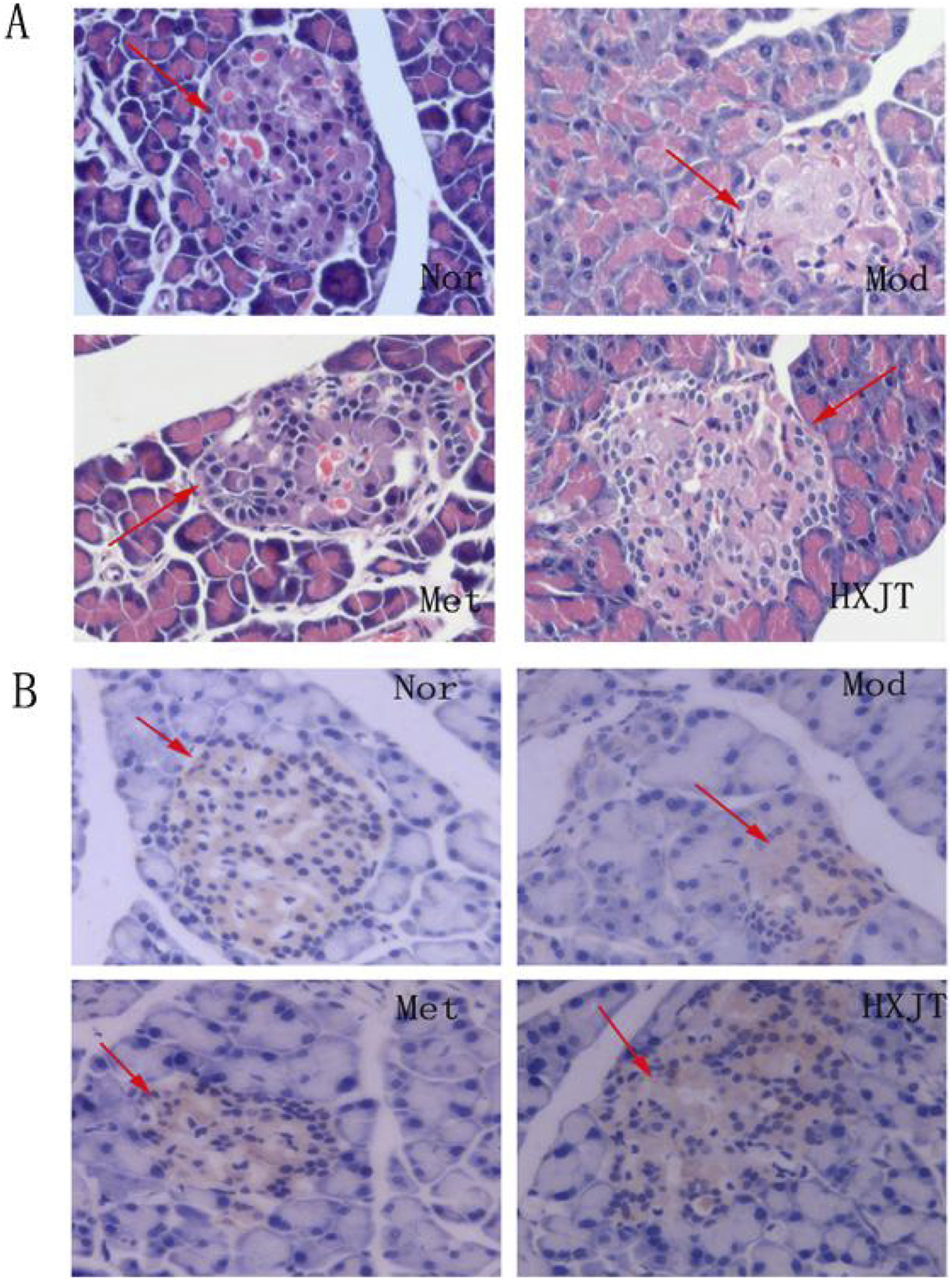 Microscopic images show kidney tissue samples in two panels labeled A and B. Panel A depicts H&E stained sections with arrows indicating specific glomerular structures in four conditions: Nor, Mod, Met, and HXJT. Panel B shows corresponding IHC stained sections highlighting protein expression in the same conditions, with arrows pointing to key features.