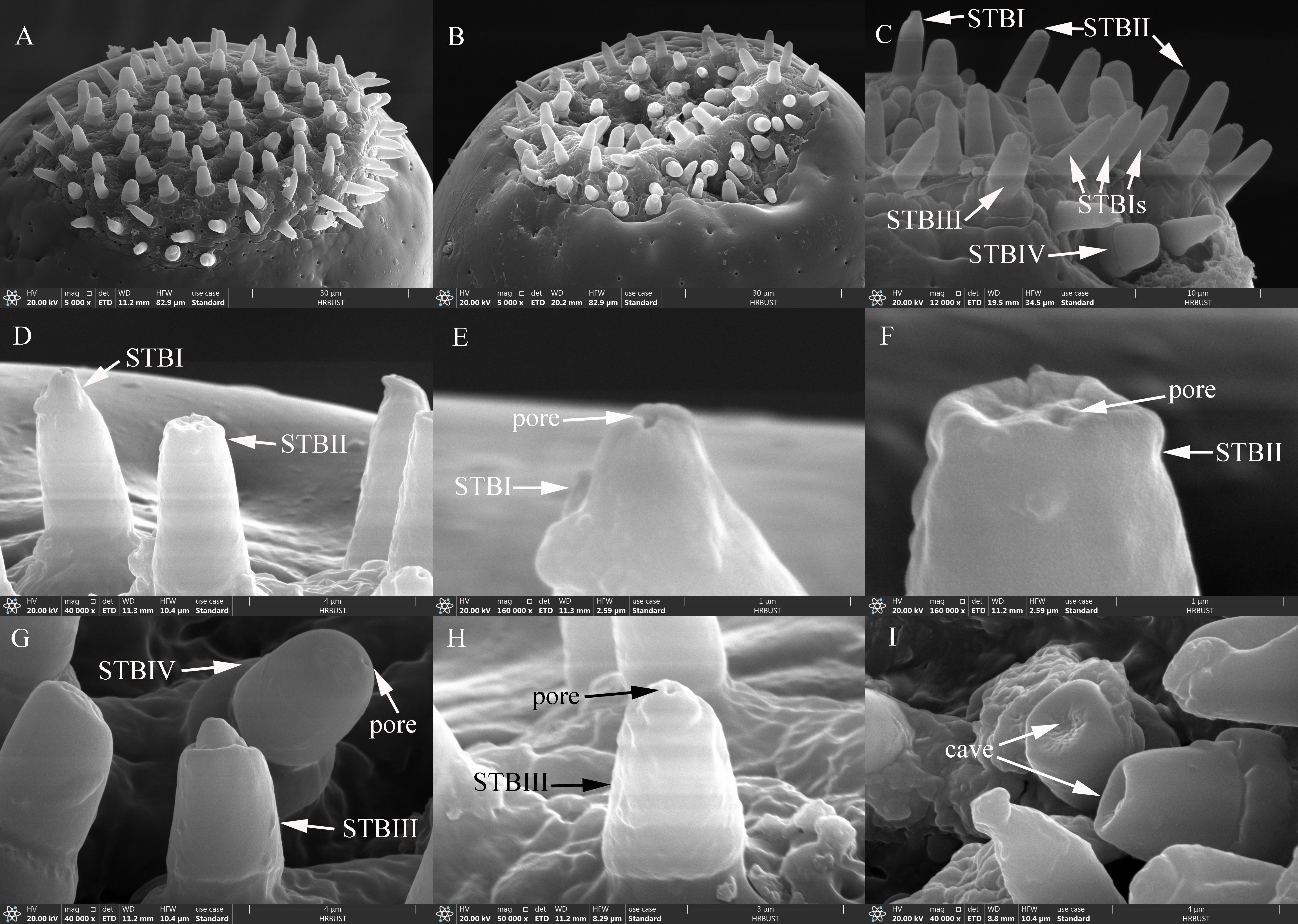Nine electron microscope images showing close-up views of structures labeled STBI, STBII, STBIII, and STBIV with visible pores. Panels A and B show surface views with various protrusions. Panel C provides a side view of the same structures. Panels D to I present detailed close-ups of individual structures, highlighting pores and specific structural variants. Each panel identifies different features and characteristics of these microscopic structures.