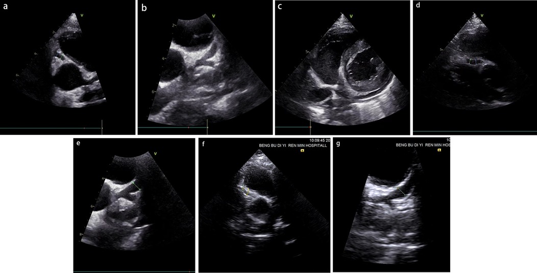 Seven ultrasound images showing various views of internal organs. The images, with white and black contrast areas, feature different shapes and sizes of anatomical structures, captured at different angles. The captions include hospital information and measurements.
