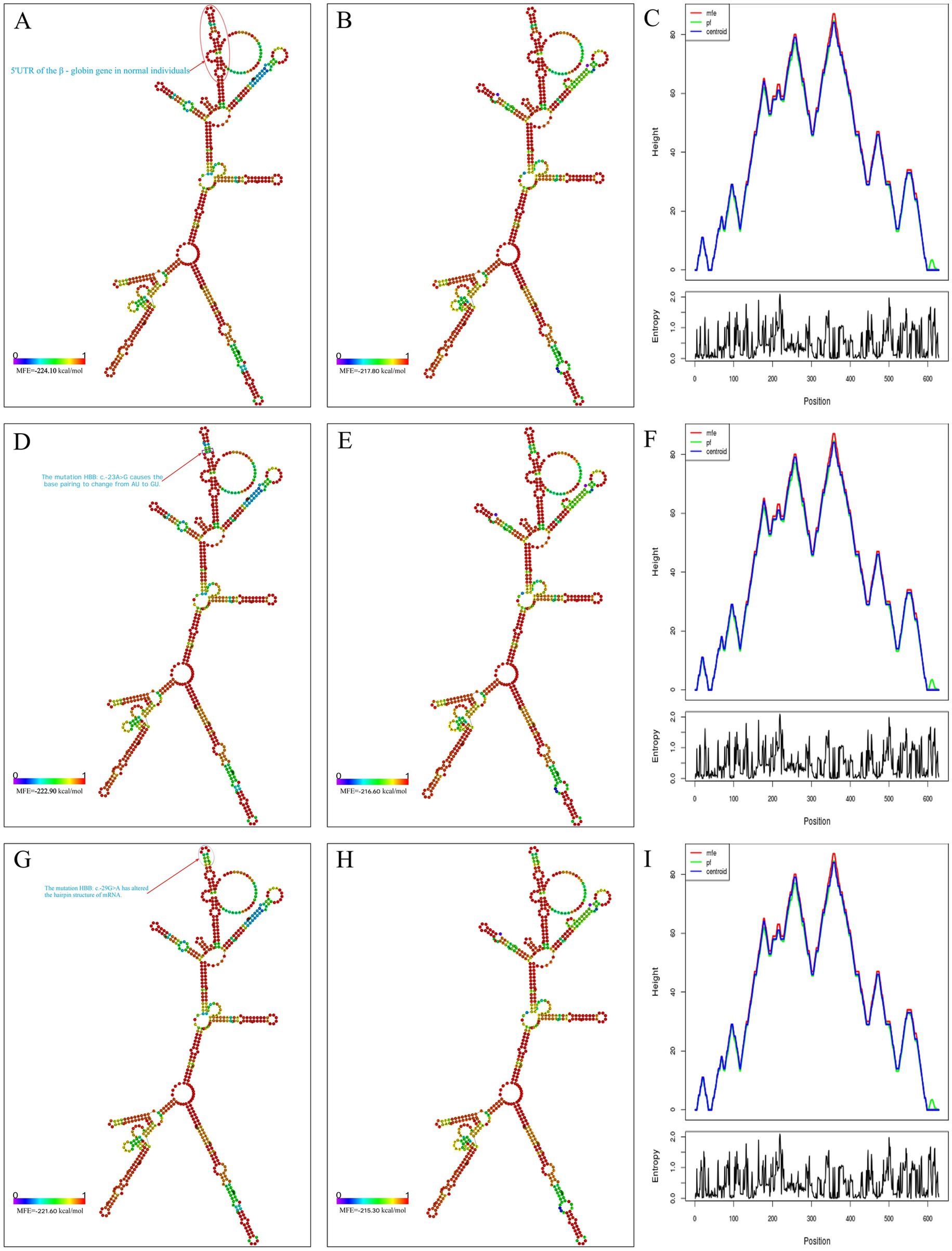 Visual representations of RNA secondary structures and energy plots. Panels A, B, D, E, G, and H show RNA folding structures with variations in base pairing, marked by colors indicating energy levels. Each has a minimum free energy value noted. Panels C, F, and I display line graphs with height and energy versus position, comparing wild-type and control samples. Text annotations in Panels A and G indicate specific mutations affecting the RNA structures. The diagrams highlight differences in RNA folding due to genetic mutations.