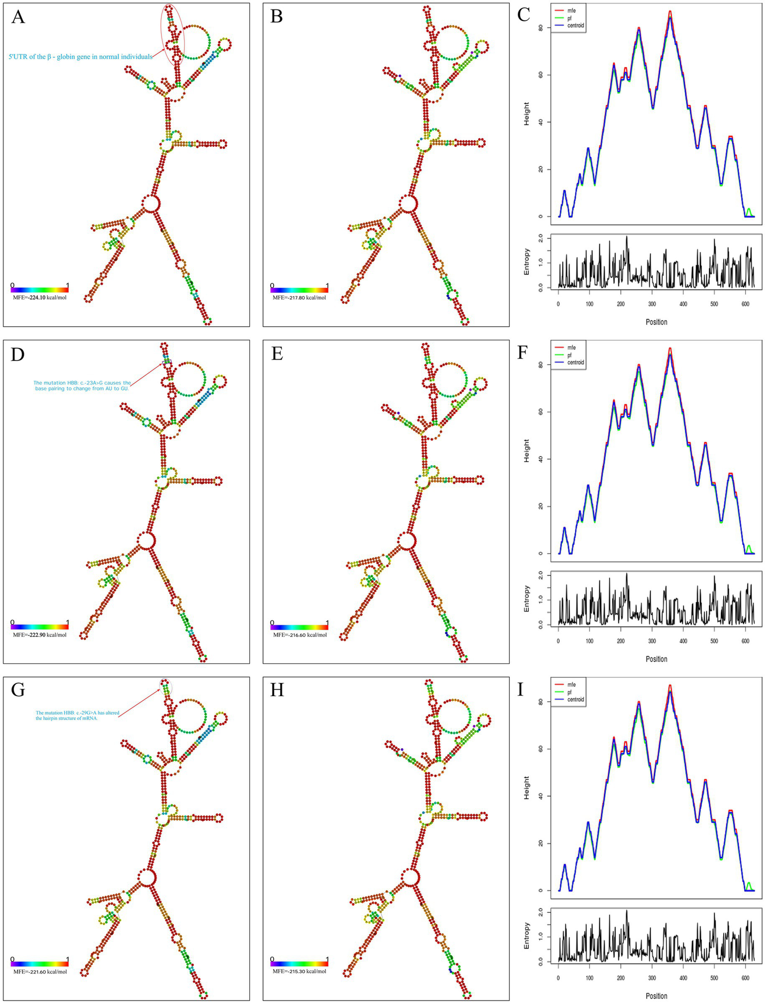 Visual representations of RNA secondary structures and energy plots. Panels A, B, D, E, G, and H show RNA folding structures with variations in base pairing, marked by colors indicating energy levels. Each has a minimum free energy value noted. Panels C, F, and I display line graphs with height and energy versus position, comparing wild-type and control samples. Text annotations in Panels A and G indicate specific mutations affecting the RNA structures. The diagrams highlight differences in RNA folding due to genetic mutations.
