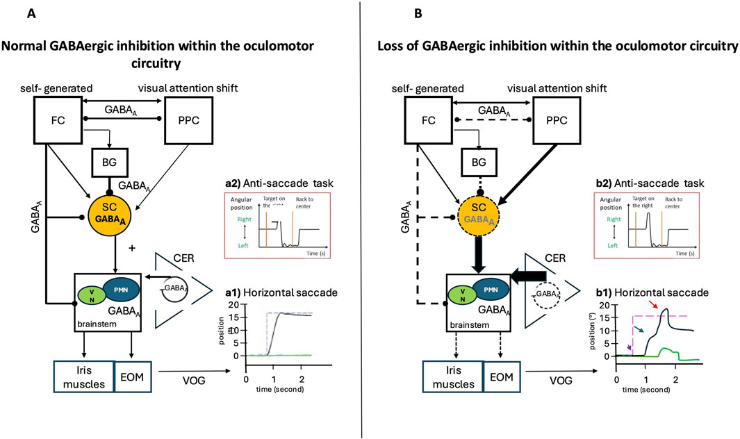 Schematic diagram showing the difference between normal and impaired GABAergic inhibition in oculomotor circuitry. Panel A demonstrates normal functioning with pathways involving FC, PPC, BG, SC, PMN, and EOM, including graphs showing anti-saccade task and horizontal saccade. Panel B illustrates the loss of GABAergic inhibition with altered pathways and similar task graphs reflecting changes in horizontal saccade behavior. Key elements are labeled, highlighting the impact on eye movements.