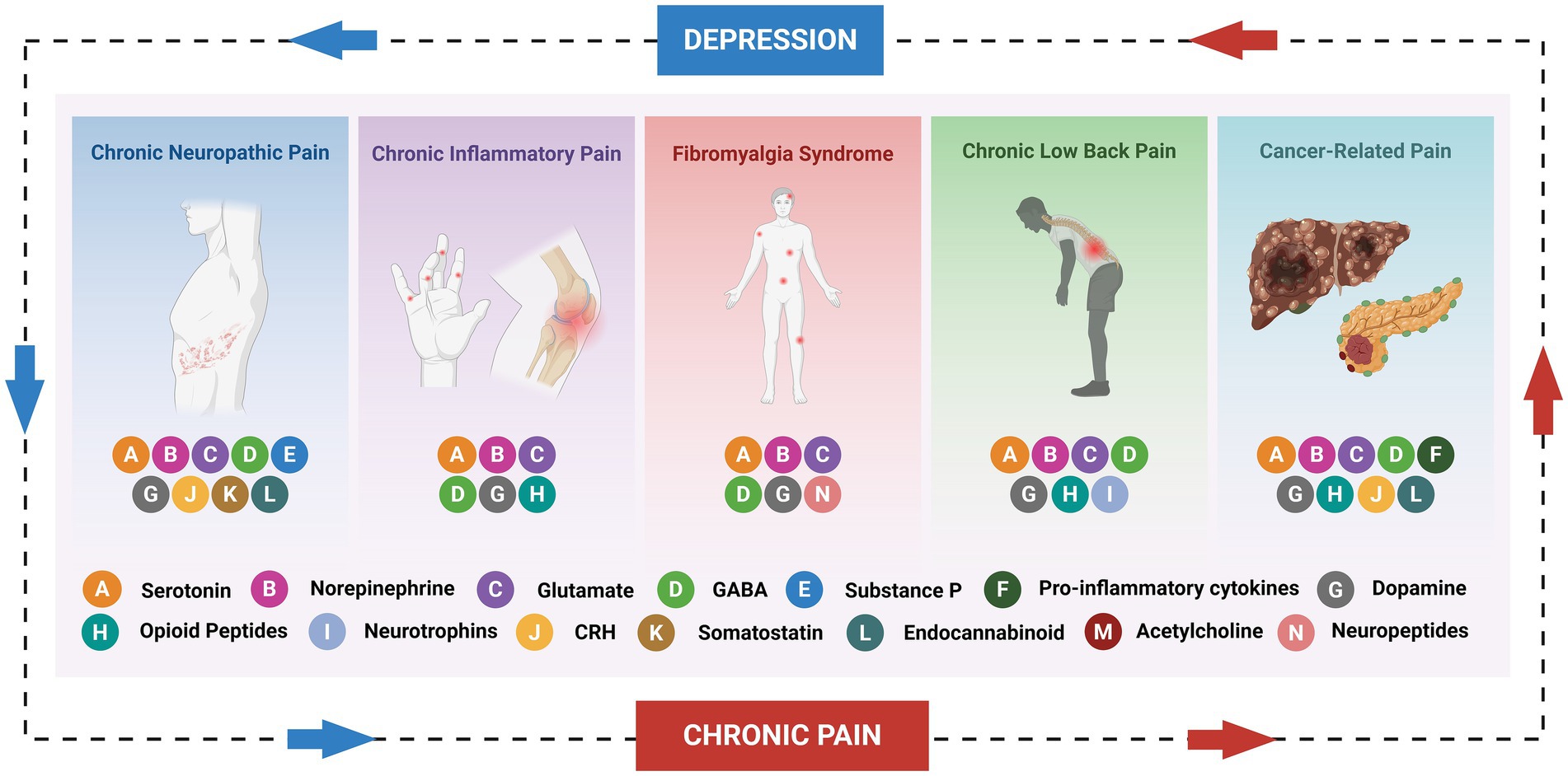 Diagram showing different types of chronic pain: neuropathic, inflammatory, fibromyalgia syndrome, low back, and cancer-related. Each type is associated with specific neurotransmitters or neuropeptides like serotonin, norepinephrine, and others. The pain types are linked to depression, with circular flow indicated by arrows.