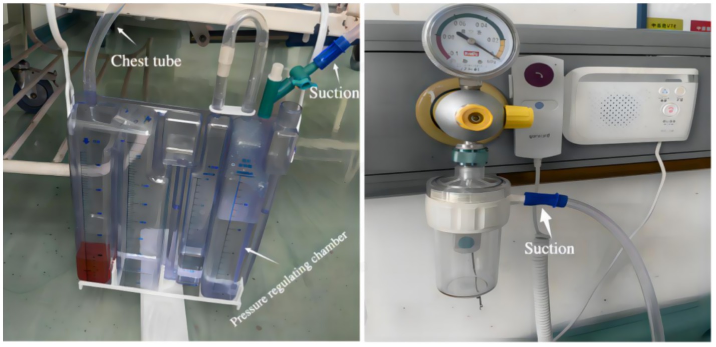 Medical equipment setup includes a chest tube drainage system on the left, with labeled chest tube and pressure regulating chamber. On the right, a suction apparatus features a pressure gauge and collection container, also labeled as suction.