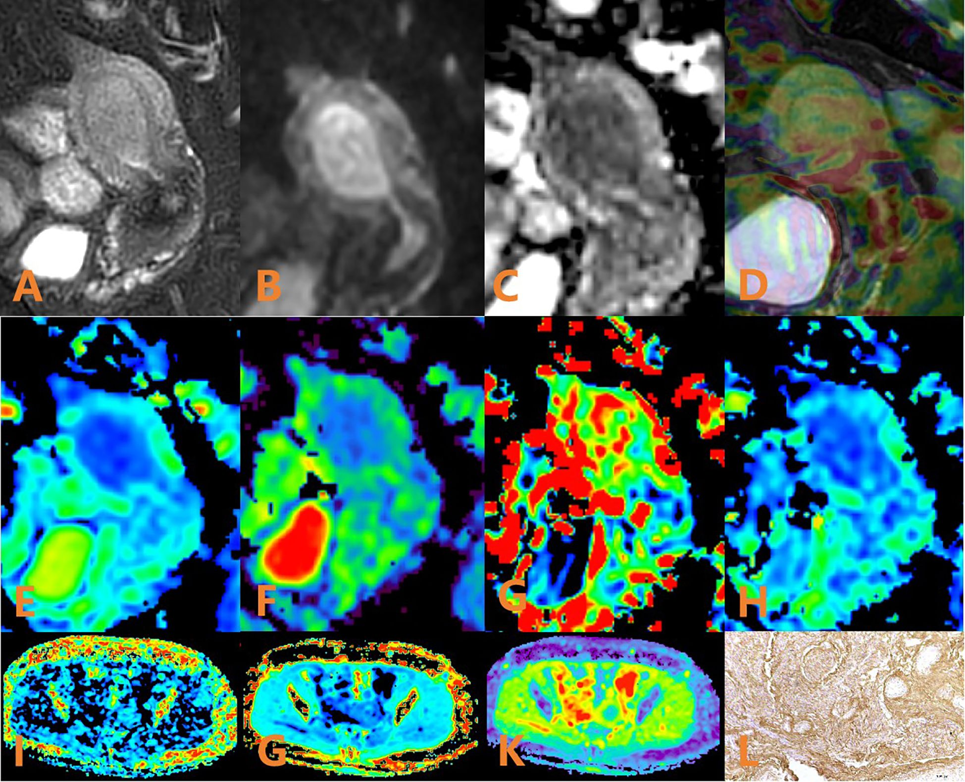 Twelve medical scan images labeled A through L. A to D are grayscale and colored scans displaying different views of internal structures. E to H are colorful heat maps with blue to red color gradients. I to K are similar heat maps in blue and red shades. L shows a tissue section under a microscope, revealing detailed cellular structures. All images appear to focus on different diagnostic imaging techniques.