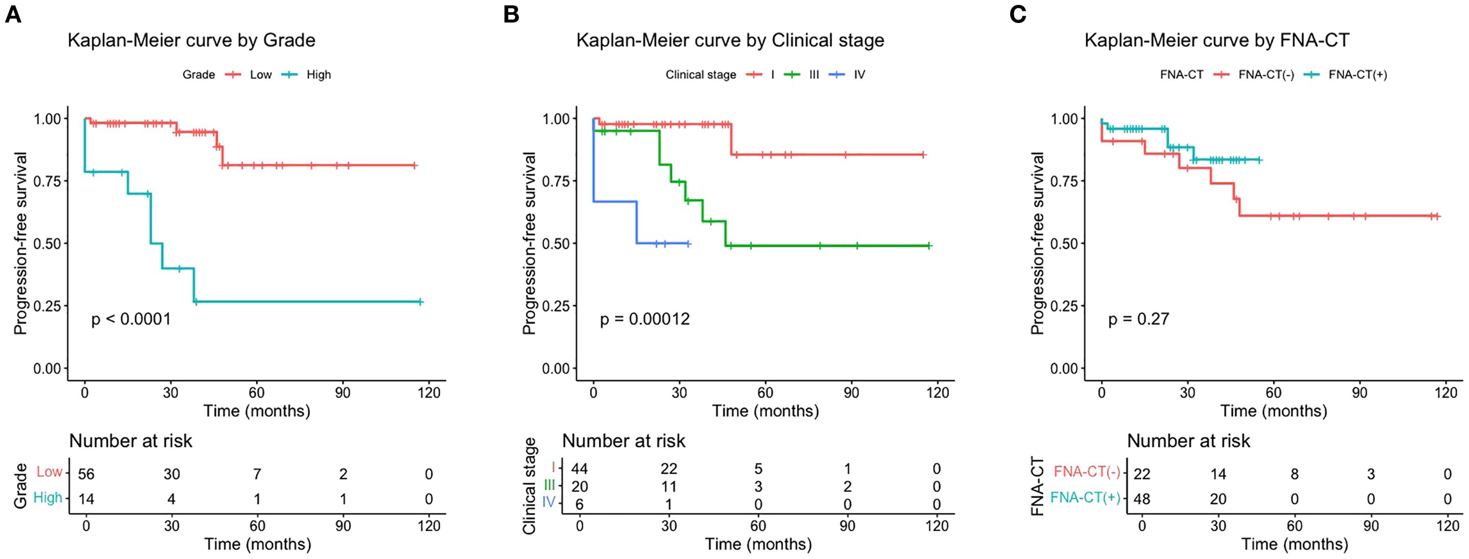 Kaplan-Meier survival curves for progression-free survival. Panel A shows a significant difference by Grade, with low grade (red) and high grade (cyan) groups. Panel B depicts a significant difference by Clinical Stage, showing stages I (red), III (green), and IV (blue). Panel C shows no significant difference by FNA-CT status, with negative (red) and positive (cyan) groups. Corresponding tables indicate the number at risk over time.