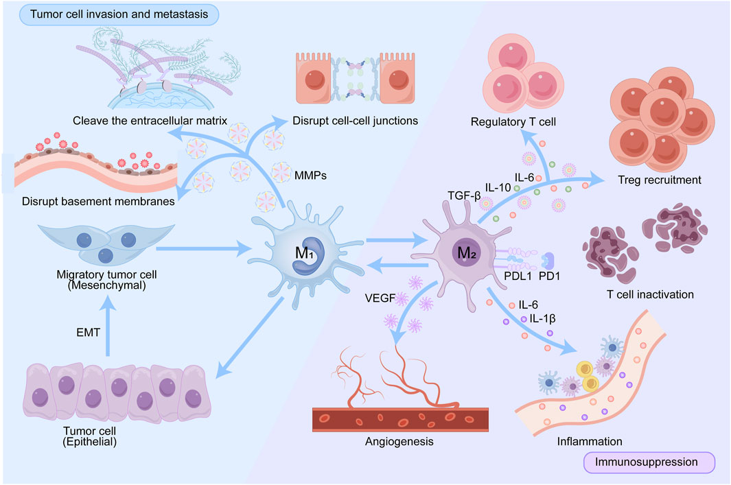 Diagram illustrating tumor cell invasion and metastasis. It shows the processes of cleaving the extracellular matrix, disrupting cell-cell junctions, and basement membranes. Migratory mesenchymal tumor cells are depicted transitioning from epithelial cells through EMT. It highlights macrophages M1 and M2, with M2 aiding angiogenesis and releasing cytokines (IL-6, IL-10, TGF-β) leading to Treg recruitment and T cell inactivation. Inflammation and immunosuppression are also represented.