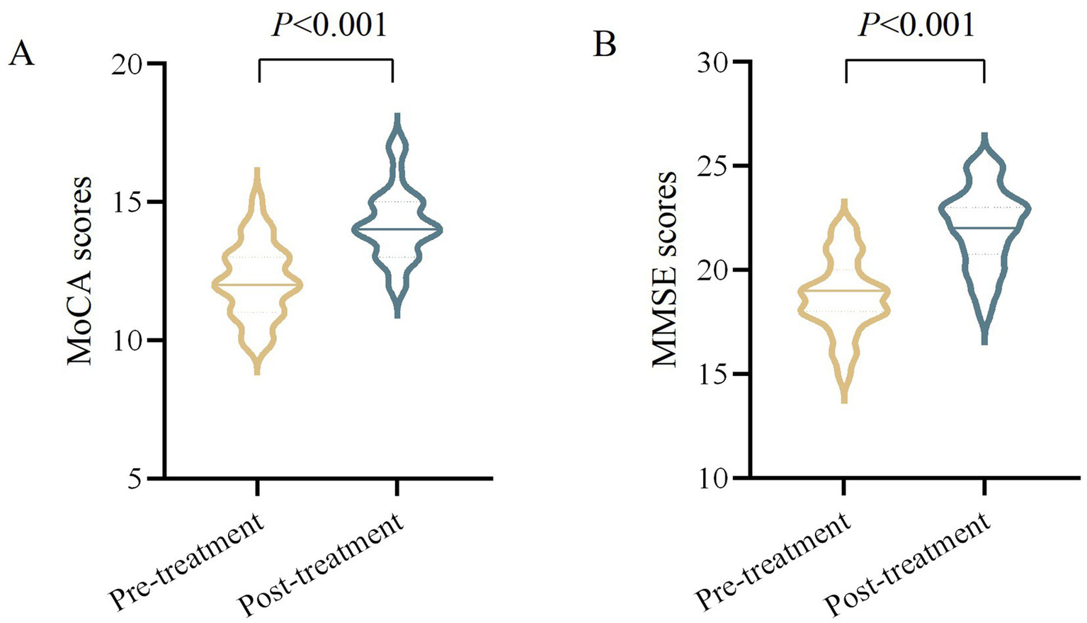 Violin plots comparing pre-treatment and post-treatment scores. Plot A shows MoCA scores, and plot B shows MMSE scores. Both show a significant increase post-treatment with p-values less than 0.001.