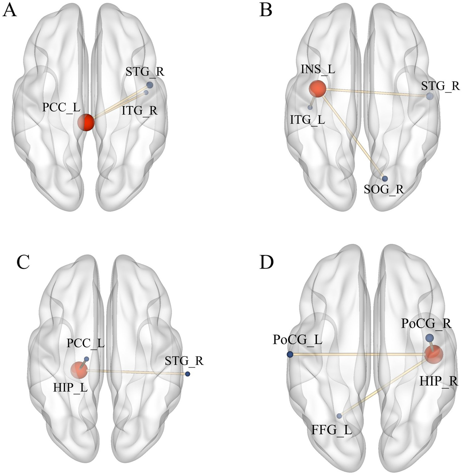 Four brain models labeled A, B, C, and D each show different regions highlighted. A displays connections between PCC_L and STG_R, ITG_R. B connects INS_L to ITG_L, STG_R, SOG_R. C links PCC_L, HIP_L, and STG_R. D shows connections among HIP_R, PoCG_L, PoCG_R, and FFG_L. Each model illustrates neural pathways with colored markers.