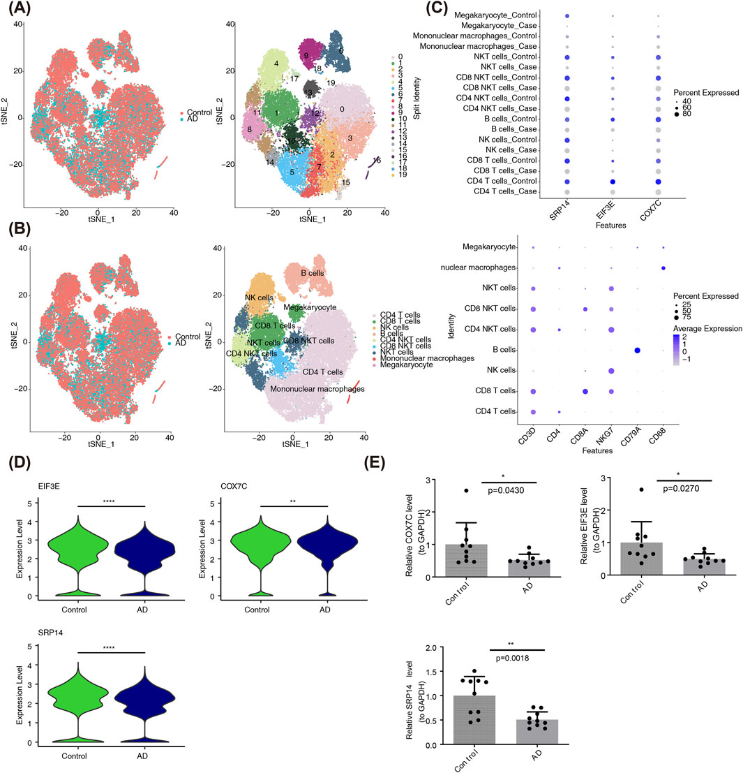 Panel (A) shows t-SNE plots depicting cell clusters and split density in control and AD conditions. Panel (B) presents t-SNE plots indicating cell types such as NK cells and mononuclear macrophages. Panel (C) displays bubble plots for expression and percent expressed features among different cell types. Panel (D) illustrates violin plots for expression levels of EIF3E, COX7C, and SRP14 in control and AD. Panel (E) contains bar charts with dots showing relative expression levels with p-values comparing control and AD conditions.