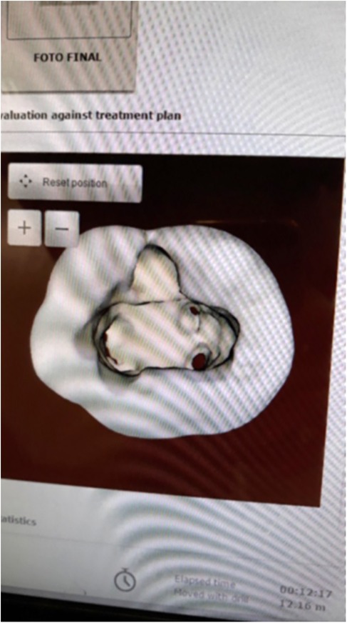 Computer screen displaying a dental image with text \