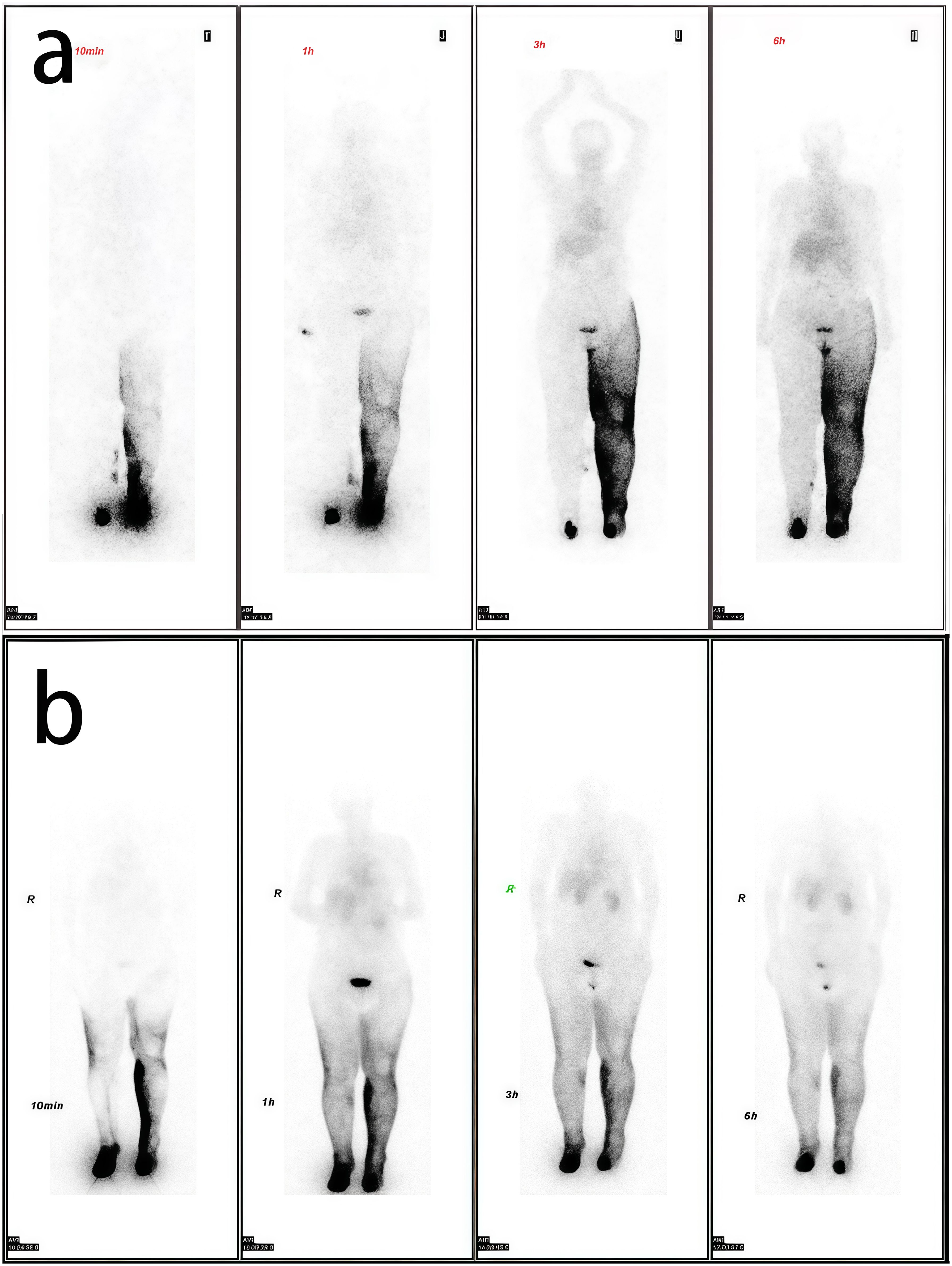 Two series of four sequential body scan images labeled “a” and “b”. Each series shows progressive changes in image clarity and shadowing over time, labeled with durations 10 minutes, 1 hour, 3 hours, and 6 hours. Top series shows arms at sides; bottom series shows arms crossed. Black and white imagery with annotations.