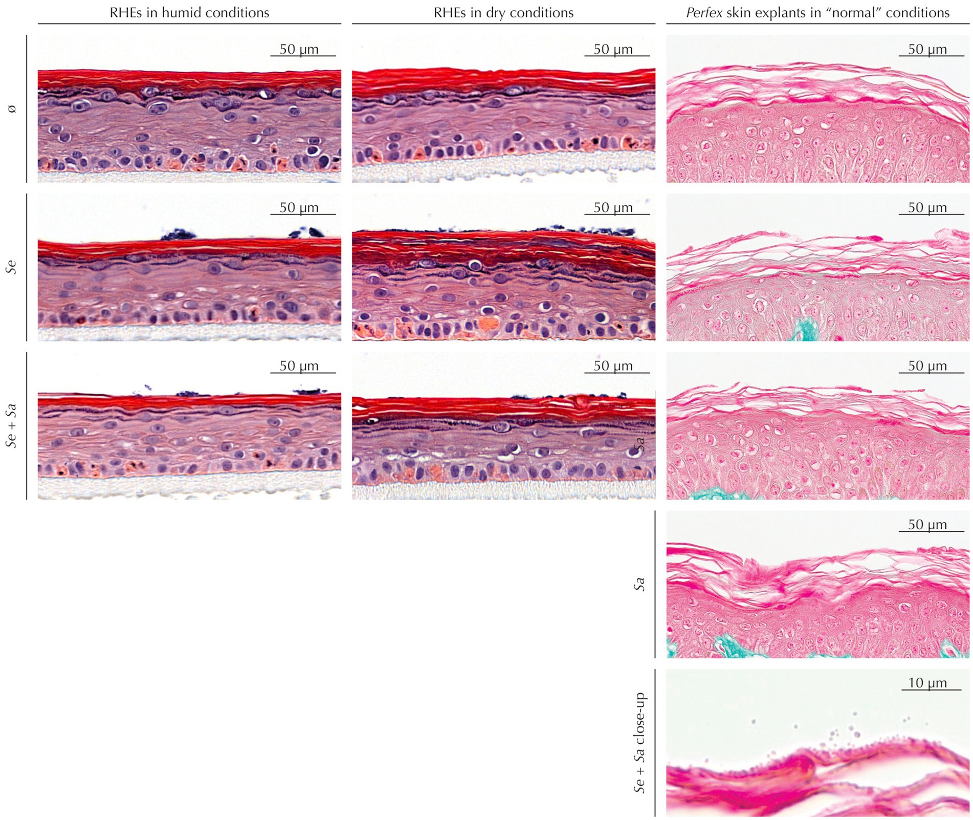 Histological comparison of reconstructed human epidermis (RHE) and Perfex skin explants under various conditions. The images display layers of epidermis stained to highlight cell structures. The left column shows RHE in humid conditions, the middle column in dry conditions, and the right column Perfex skin in normal conditions. Each row represents different experimental scenarios indicated by labels: ø, Sc, Sc + Sa, and a close-up of Sc + Sa. Scale bars indicate magnification levels of fifty micrometers and ten micrometers.